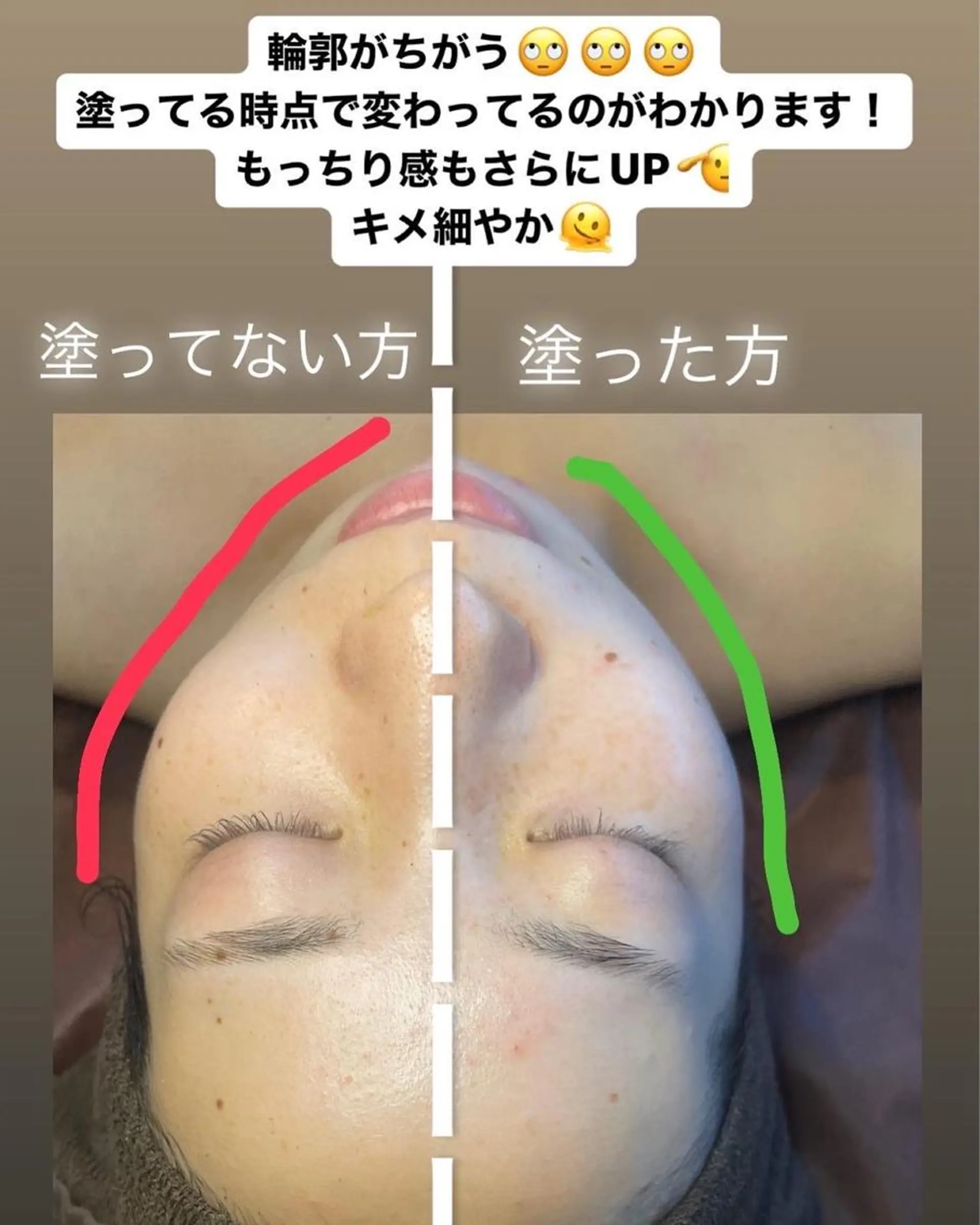 エステ 肌育脱毛サロン LikoLinaのその他イメージ