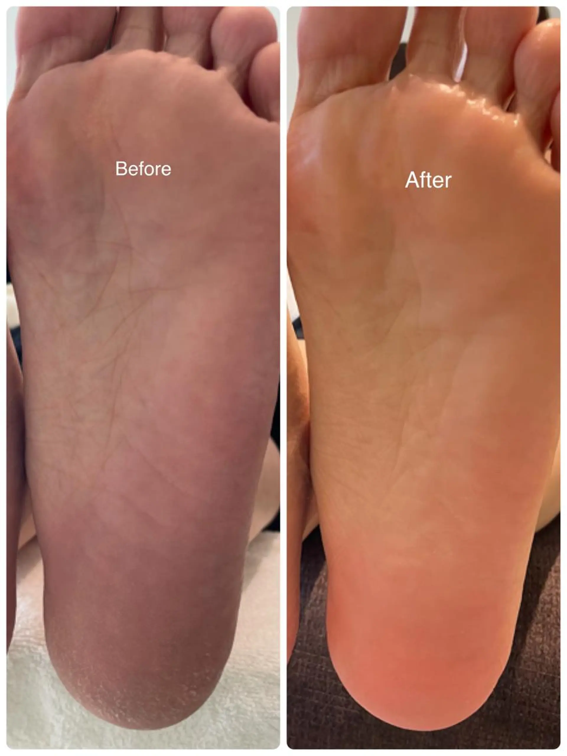 ネイル フットネイル Lunenail所属・Lune nailのネイルデザイン