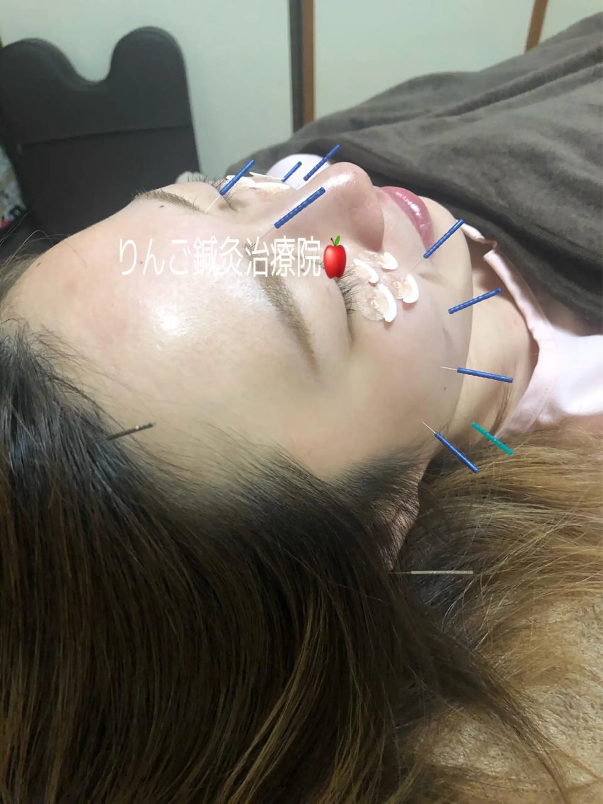 美容鍼灸女性専用 りんご鍼灸治療院のエステ・リラクイメージ