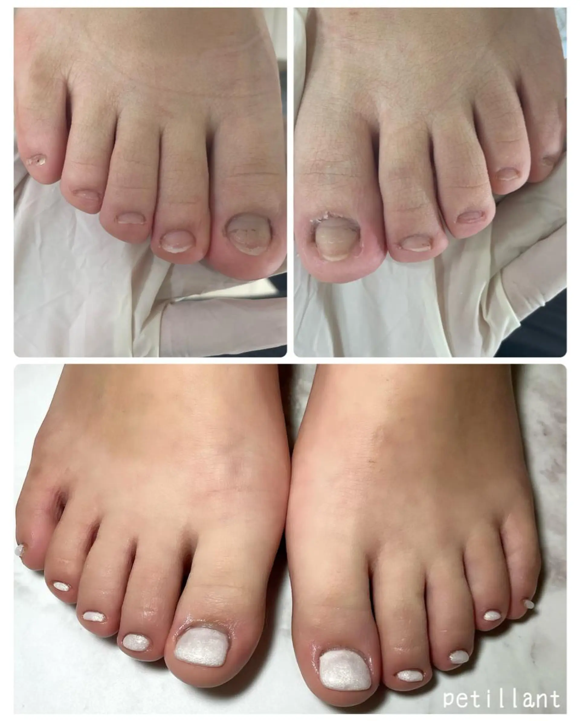 ネイル 長さ出し フットネイル petillant所属・nail salon petillantのネイルデザイン