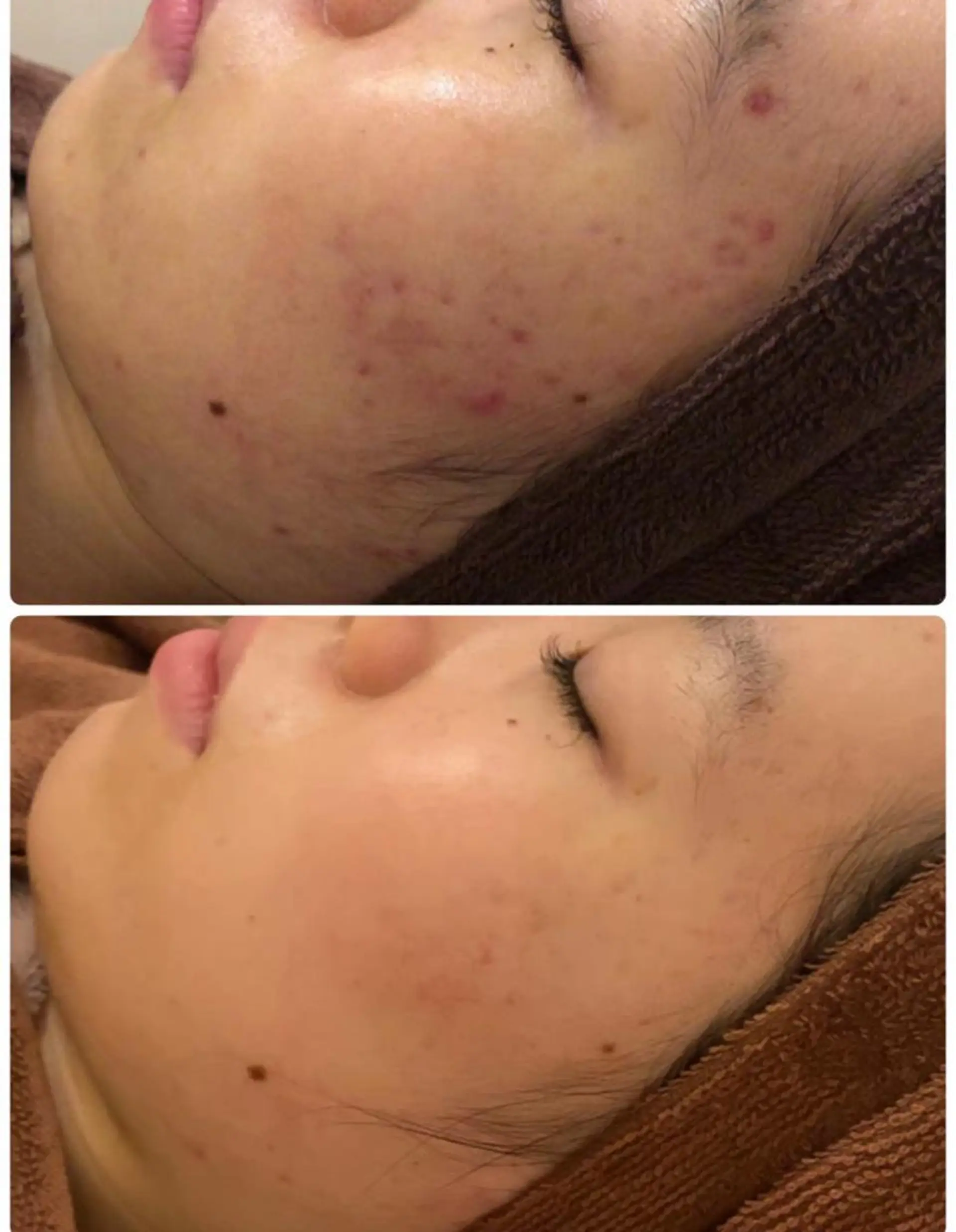 ミディアム カラー パーマ ヘアアレンジ メンズ キッズ ネイル マツエク・マツパ アイブロウ 肌質体質を変えて すっぴん肌にのエステ・リラクイメージ