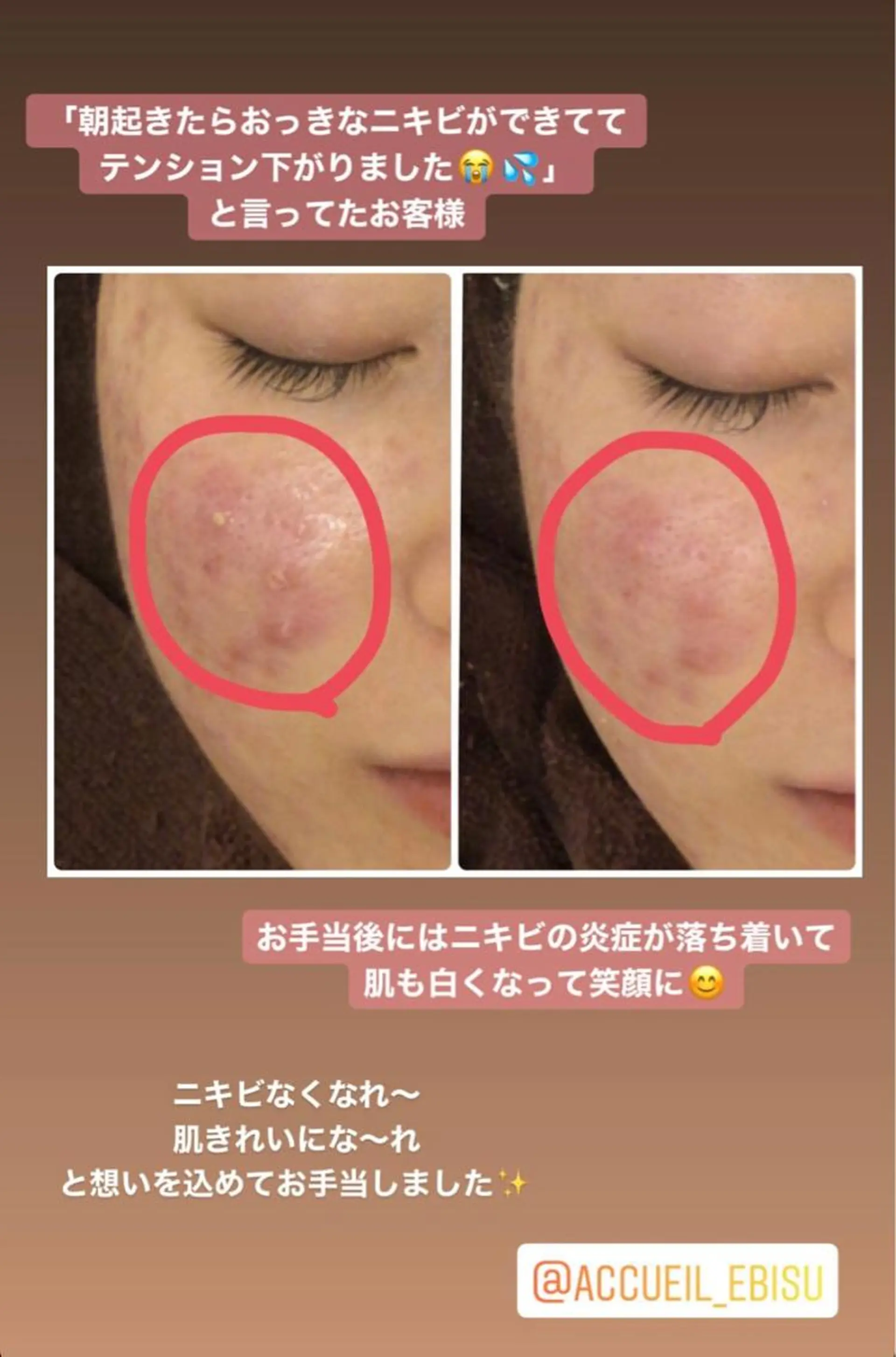 ミディアム カラー パーマ ヘアアレンジ メンズ キッズ ネイル マツエク・マツパ エステ リラク ニキビ・肌質改善専門 ♡人生が変わるサロンのエステ・リラクイメージ