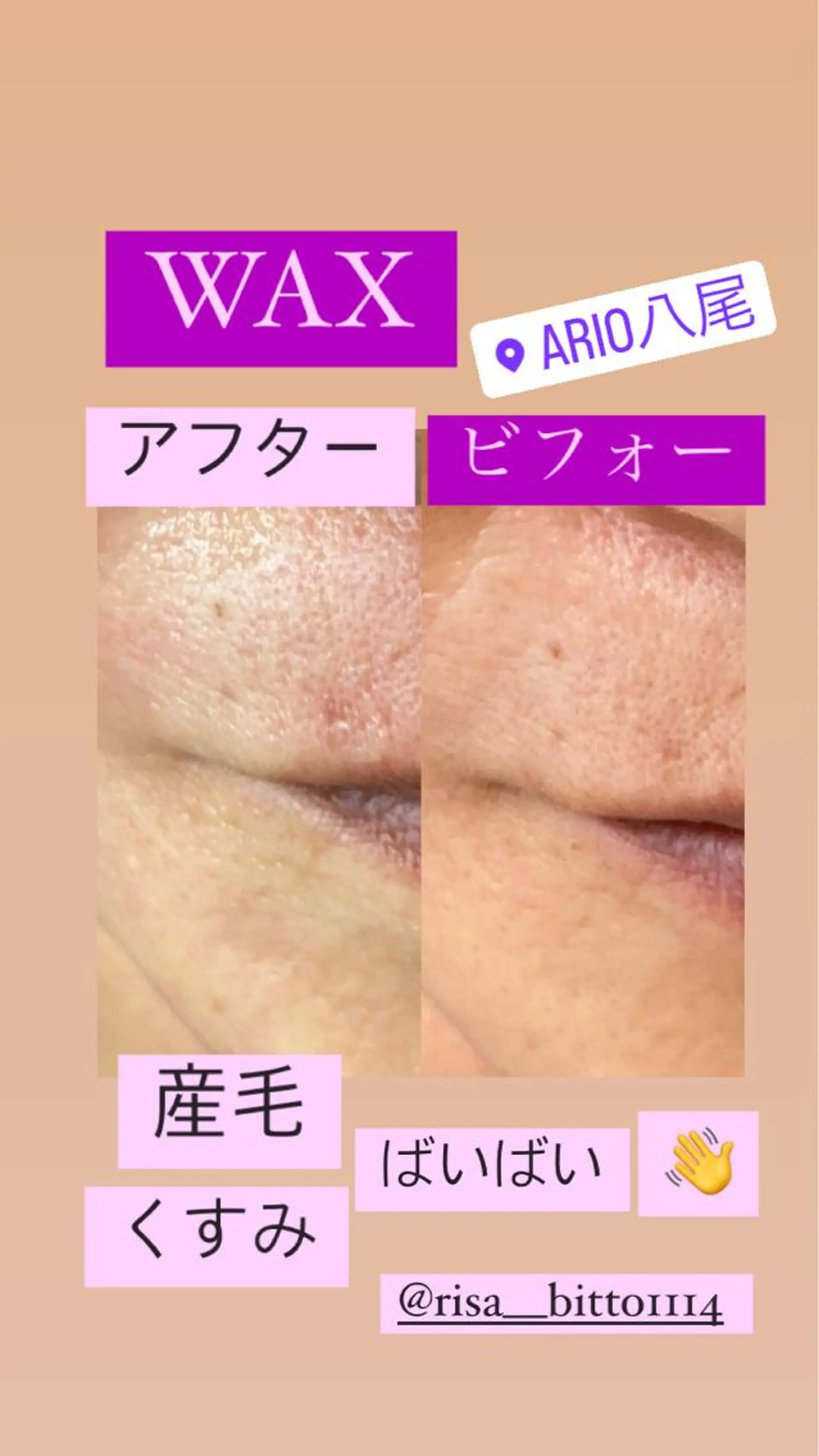 脱毛 産毛専門店 Bittoのエステ・リラクイメージ