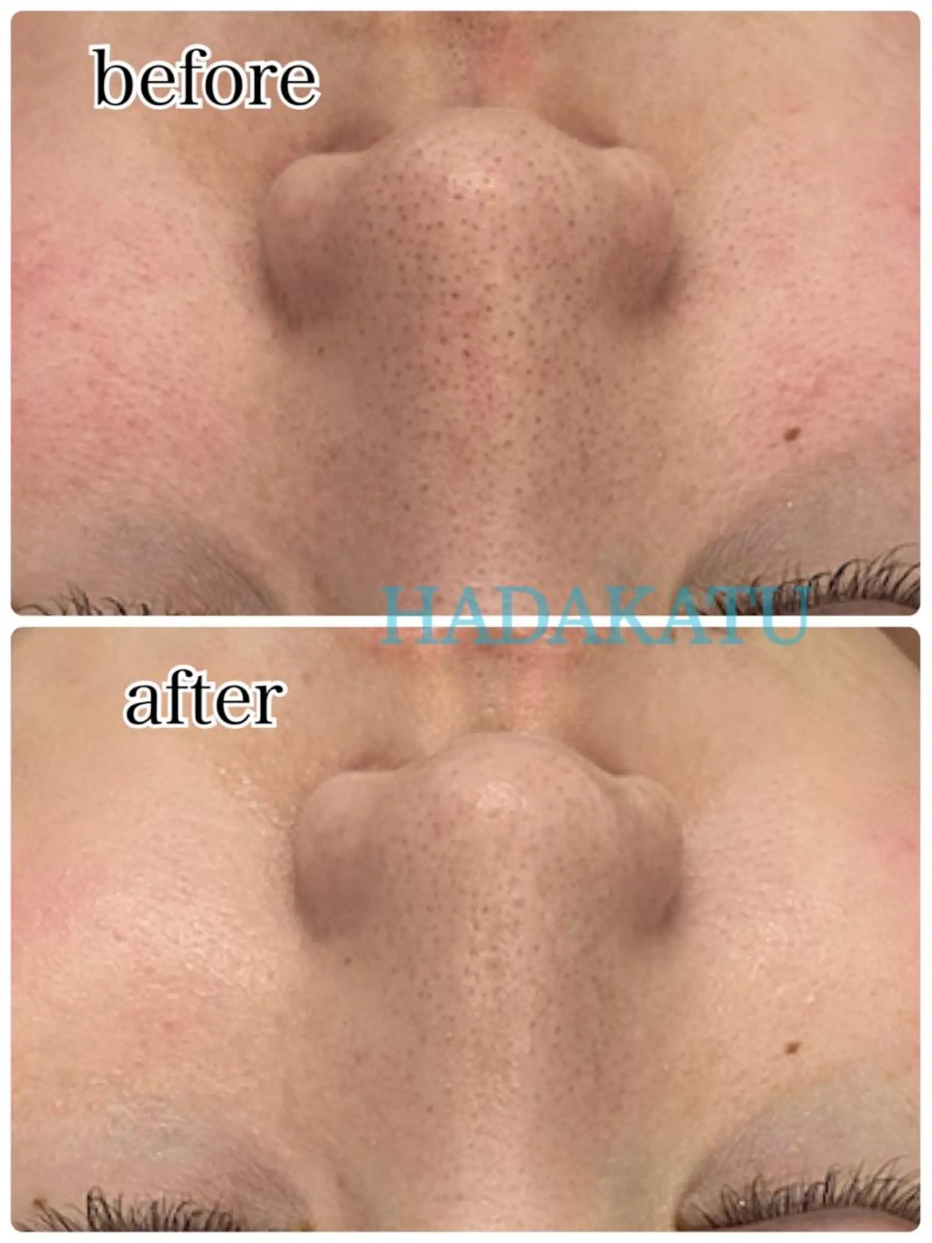 エステ 総合エステサロン 肌活のエステ・リラクイメージ