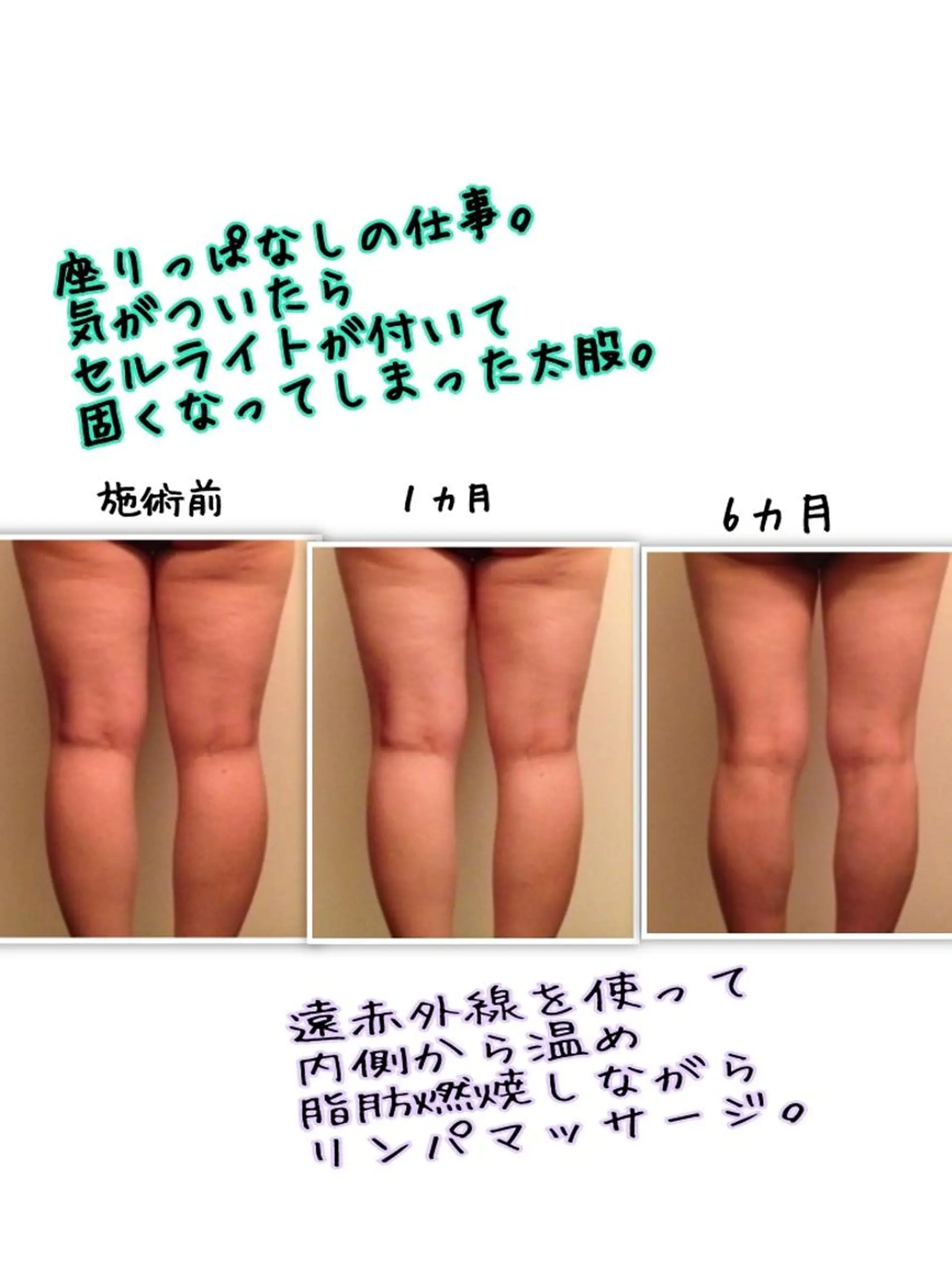 LOMILOMI Naoのエステ・リラクイメージ