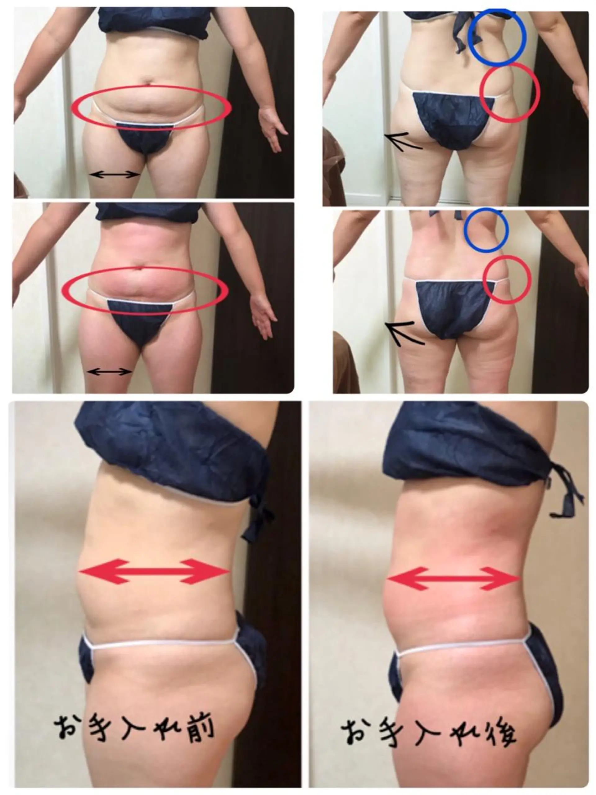 その他 ダイエット／脱毛 美顔／フォト／ハーブのその他イメージ