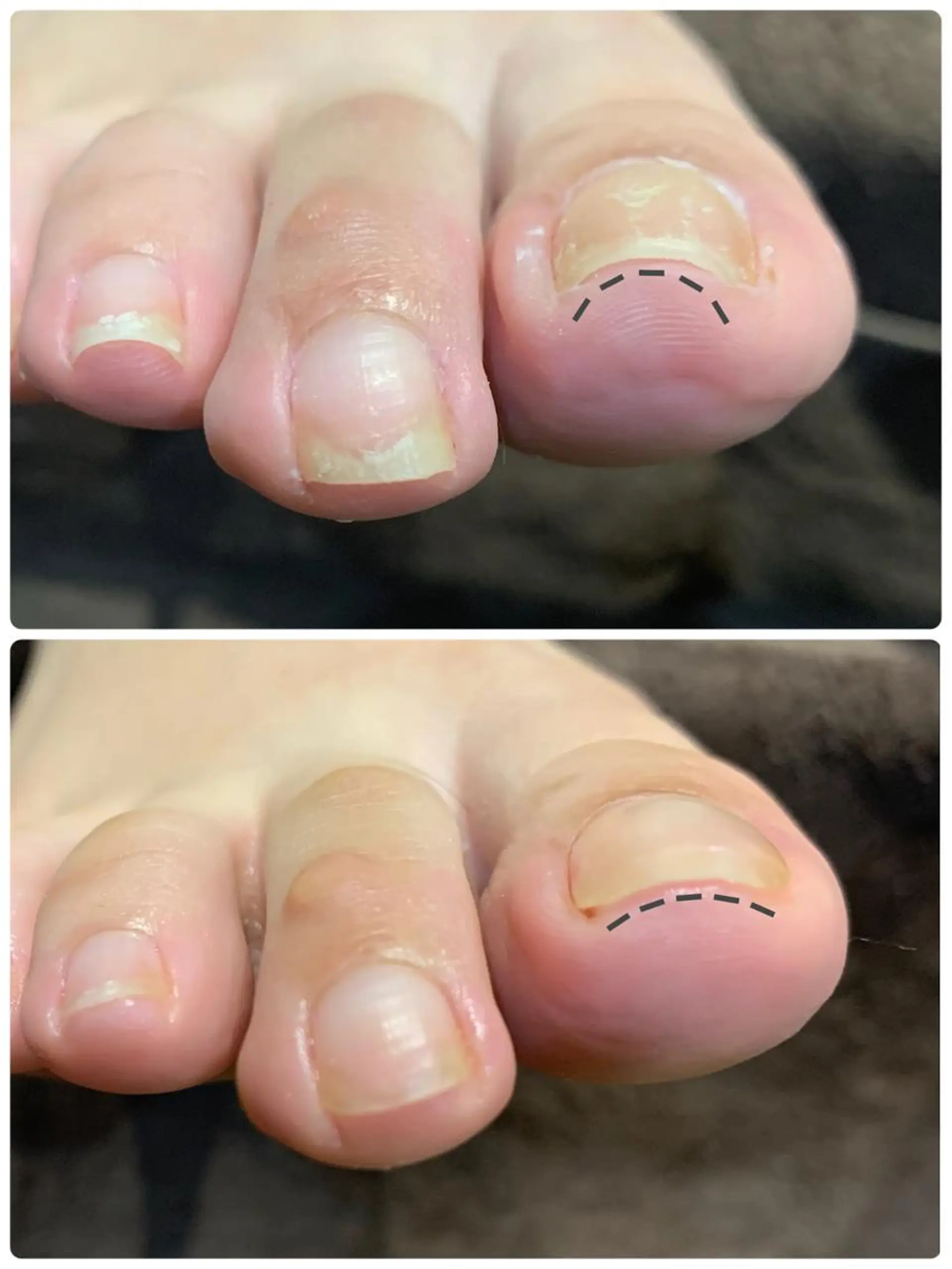 ネイル フットネイル N.barber / koderaのネイルデザイン