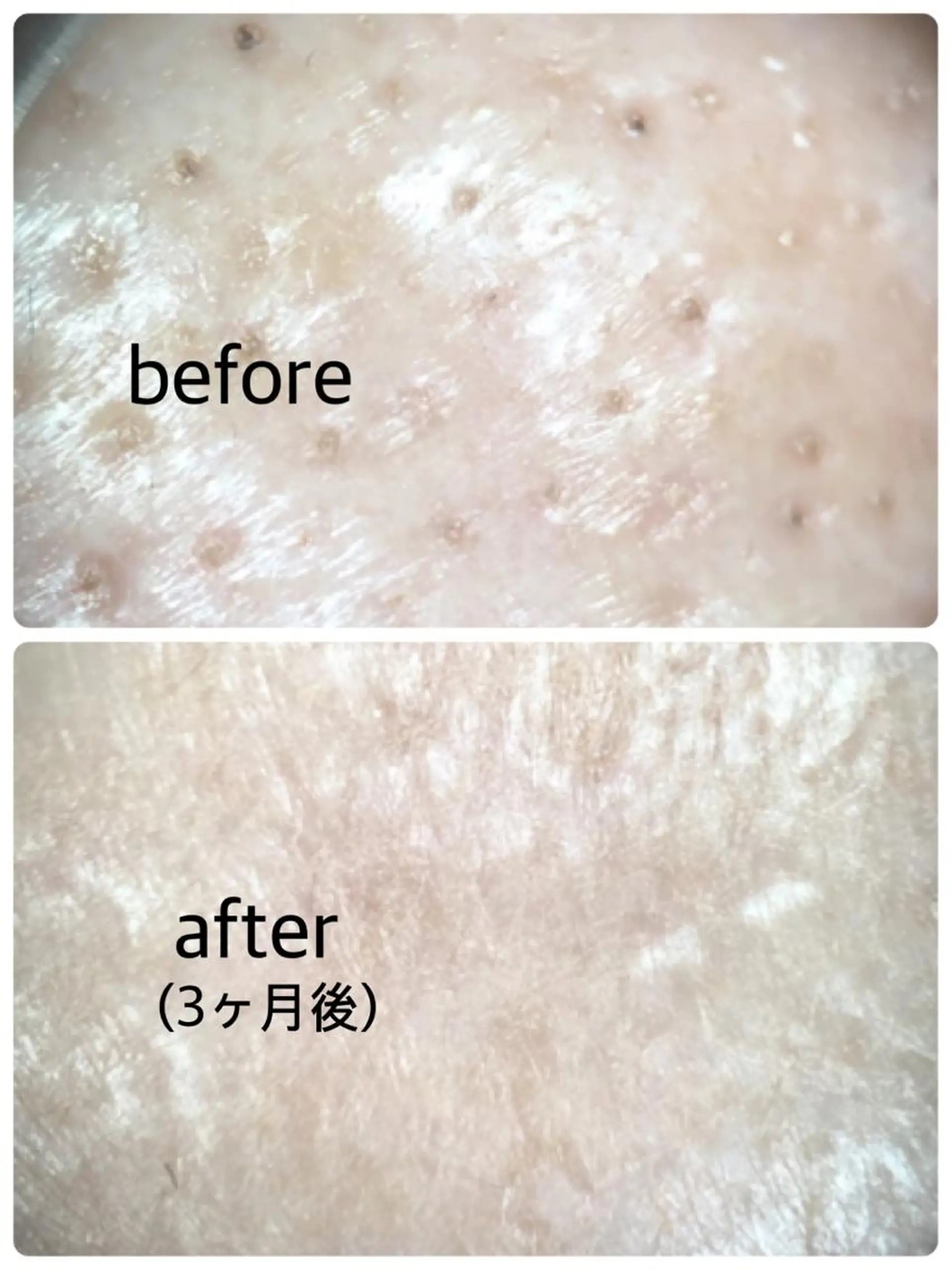 メナードフェイシャルサロン岐阜桜通所属・大橋 あつこのエステ・リラクイメージ