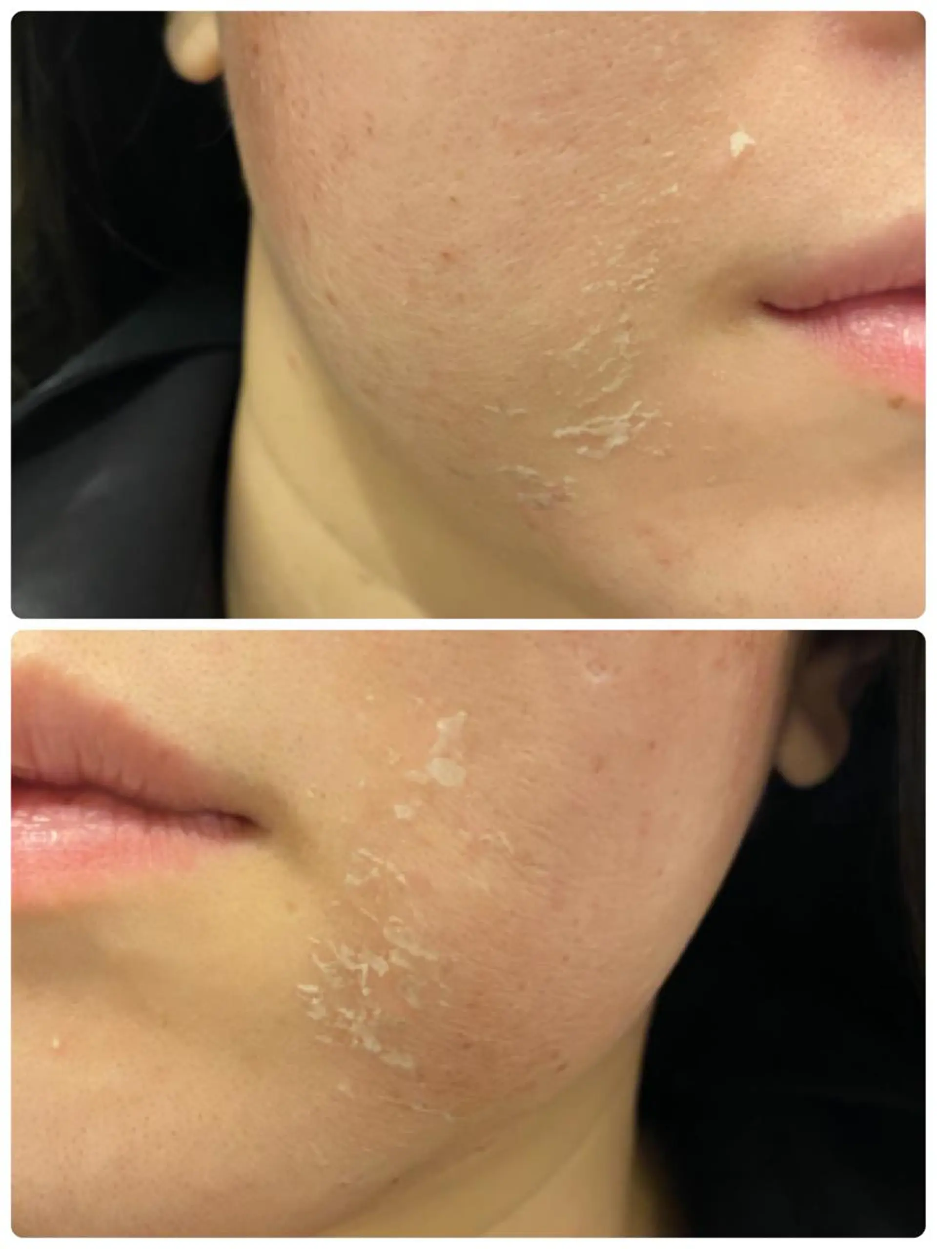 エステ 【リベルハーブピーリング認定店】敏感肌・美白脱毛専門店Dione立川店所属・Dione 立川店のエステ・リラクイメージ