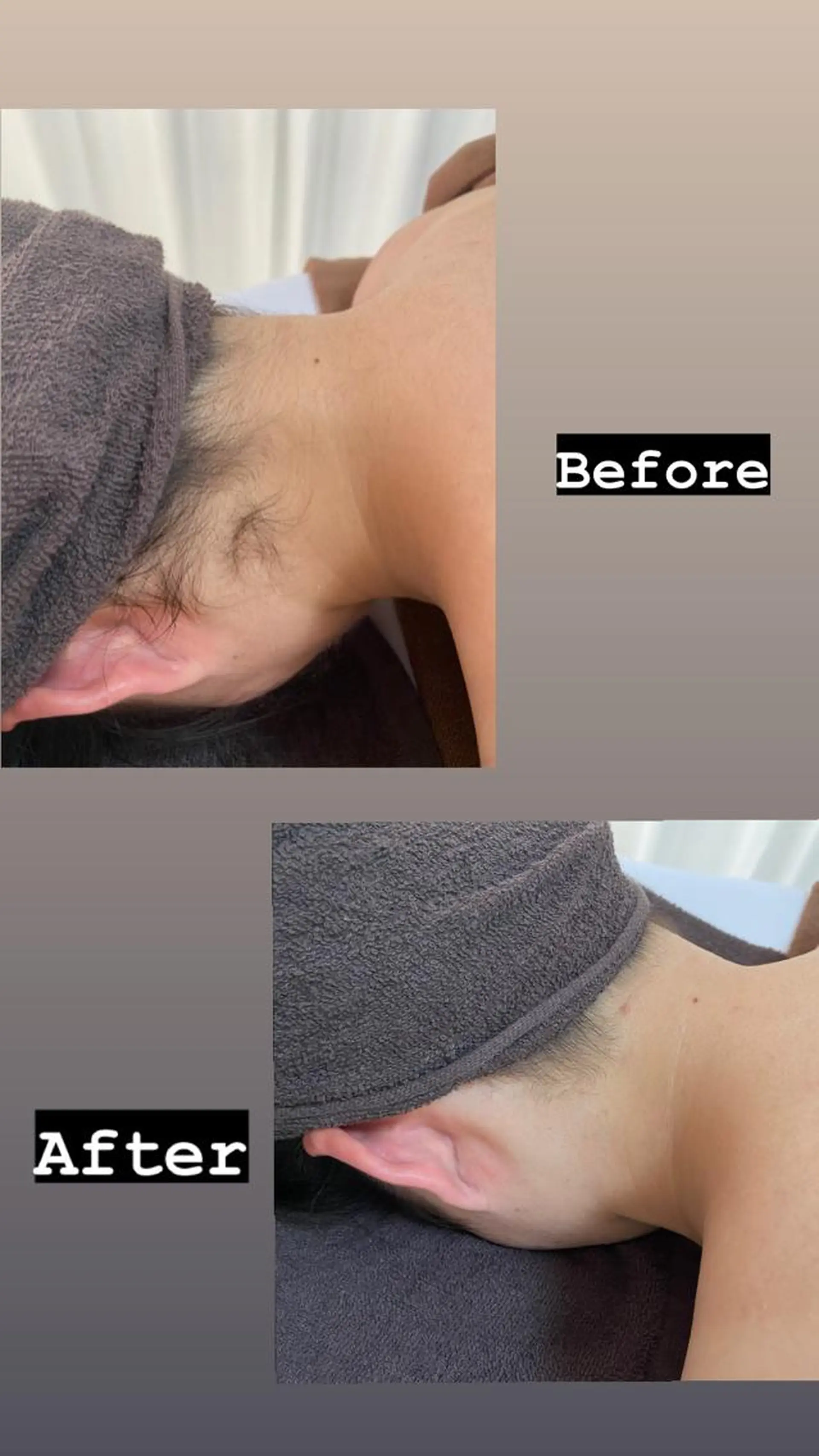 都度払い制脱毛サロンBe Charm所属・Be Charm 山﨑のエステ・リラクイメージ