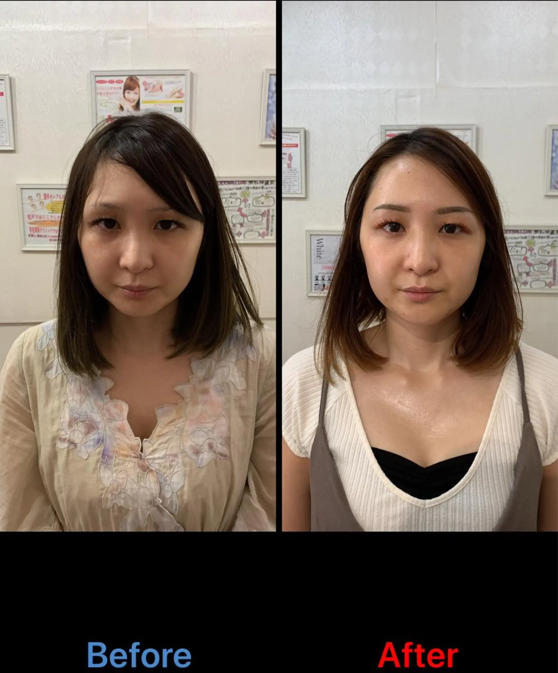 毛穴改善/脱毛 ネイル　川上久仁子のエステ・リラクイメージ