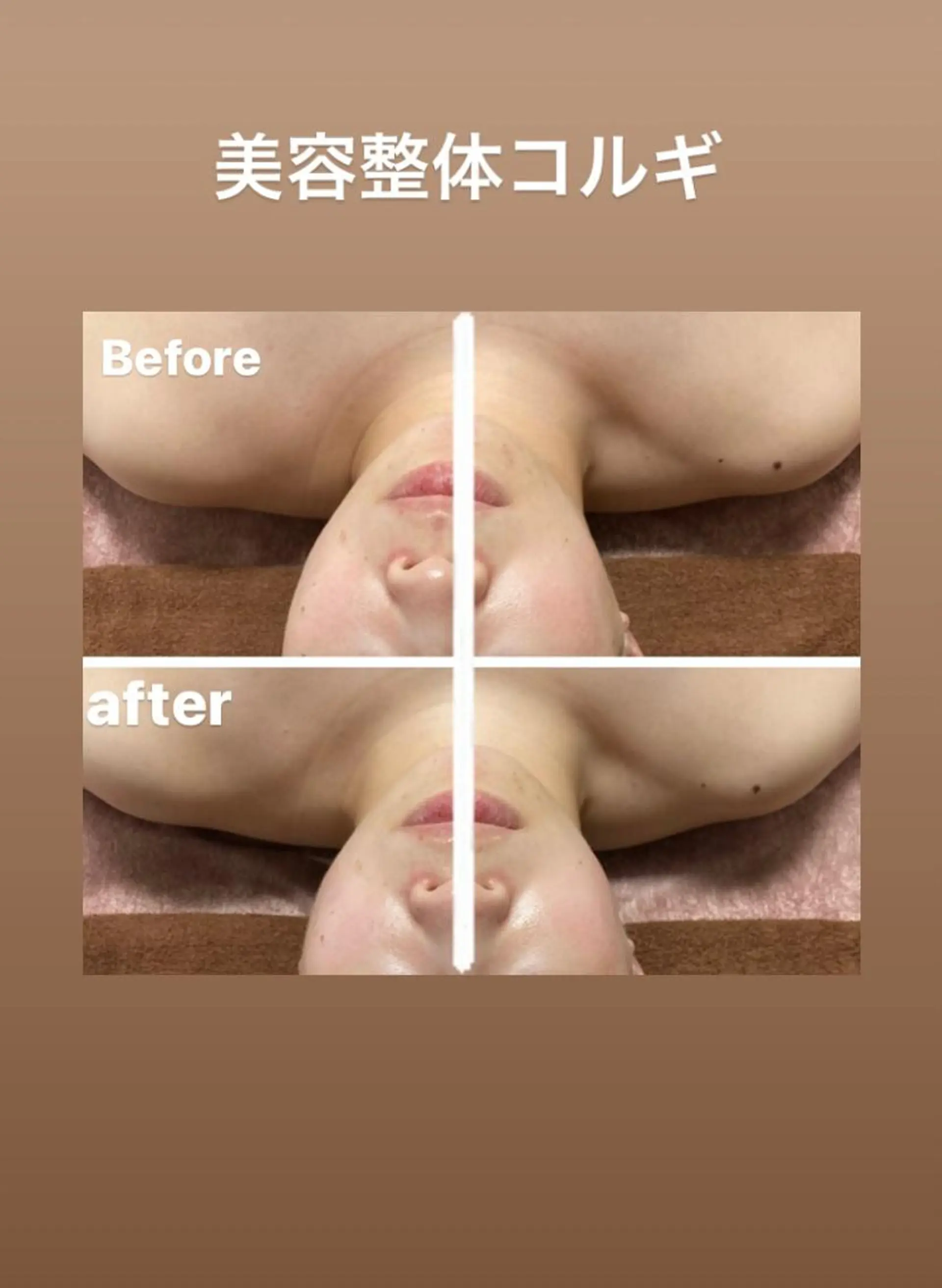 その他 美顔秘密基地新宮所属・美顔秘密基地 新宮のその他イメージ