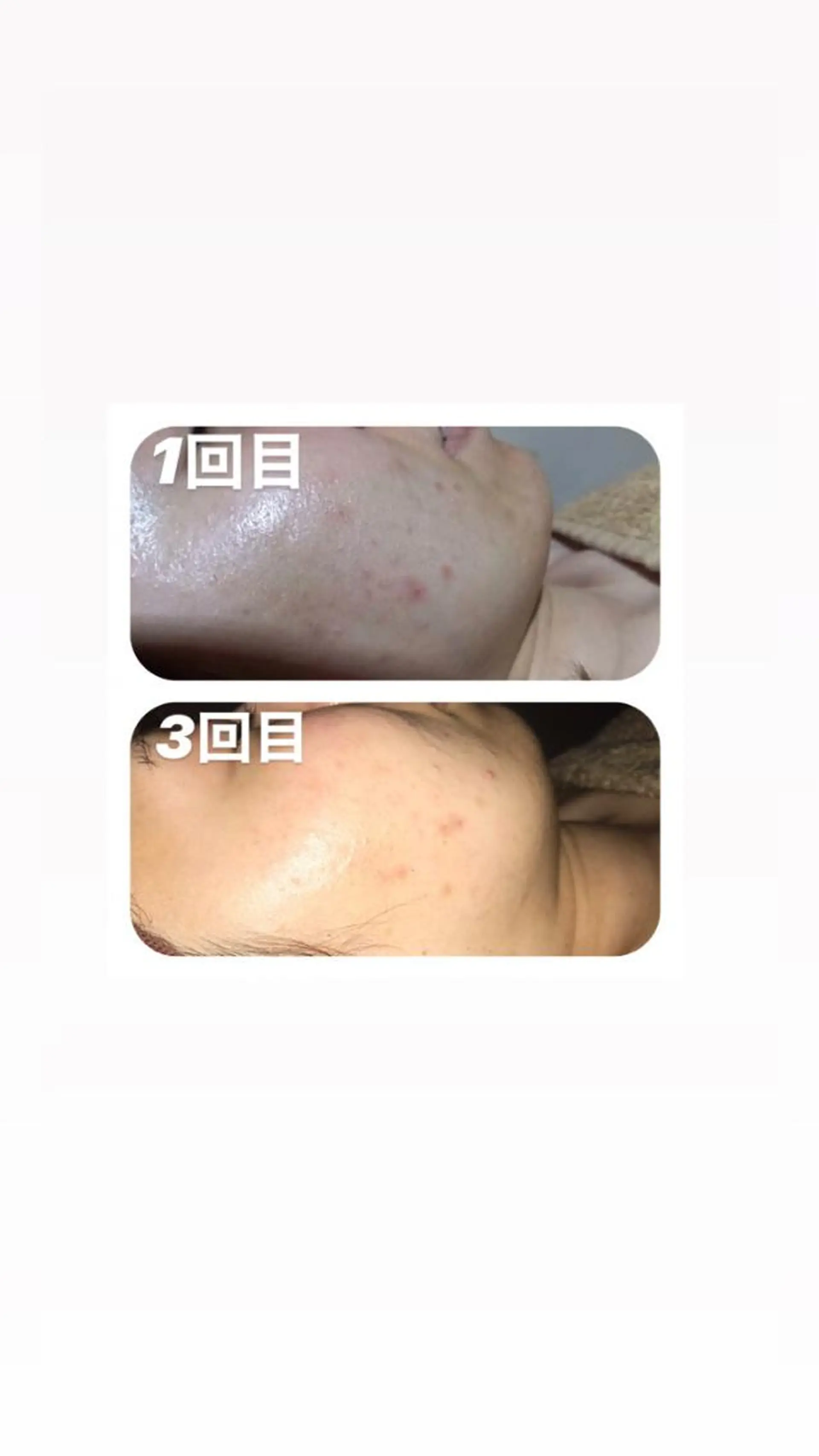 エステ 【足圧】鬼👹リンパ 身体整うサロンのエステ・リラクイメージ