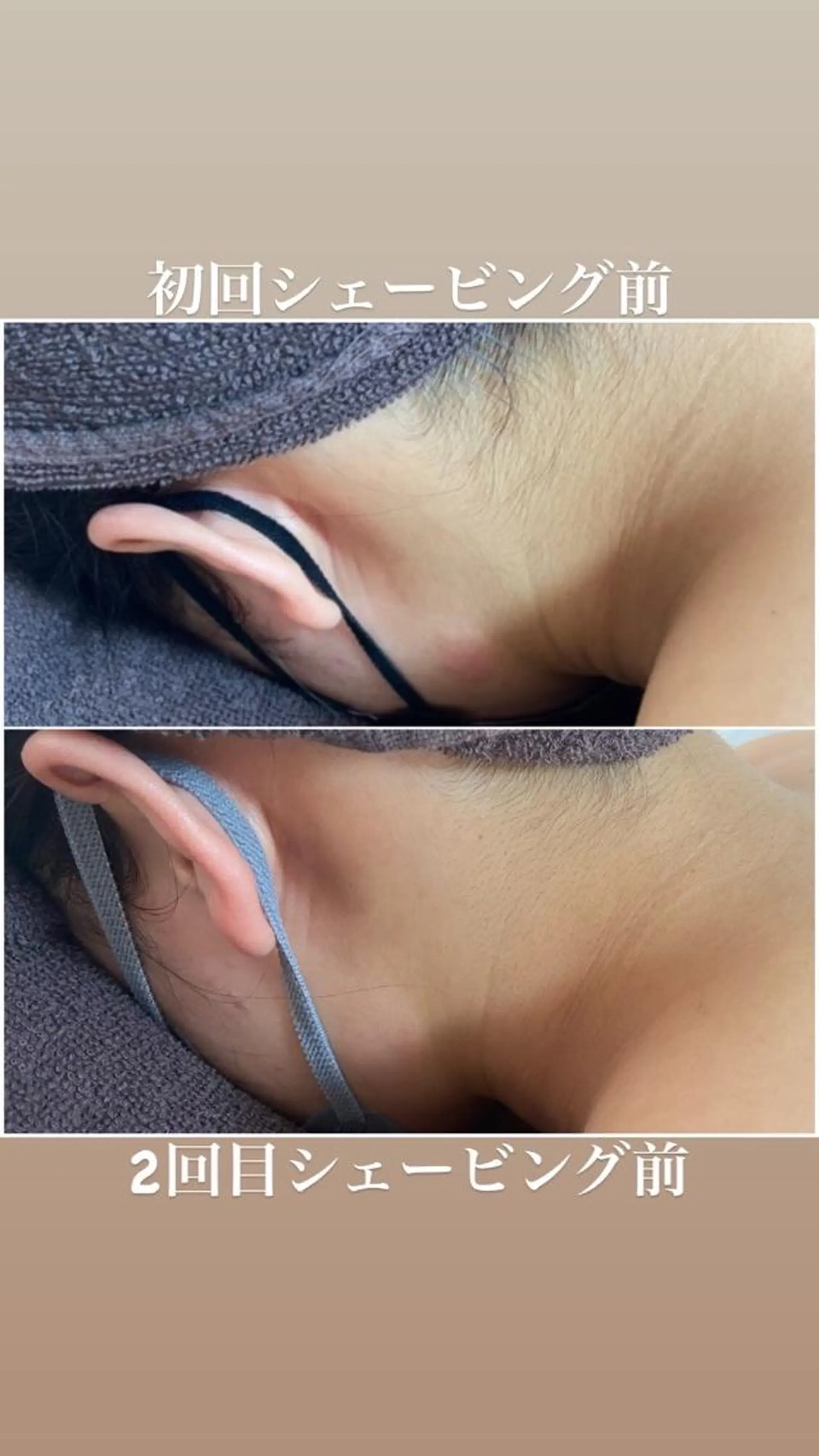 脱毛 都度払い制脱毛サロンBe Charm所属・Be Charm 山﨑のエステ・リラクイメージ