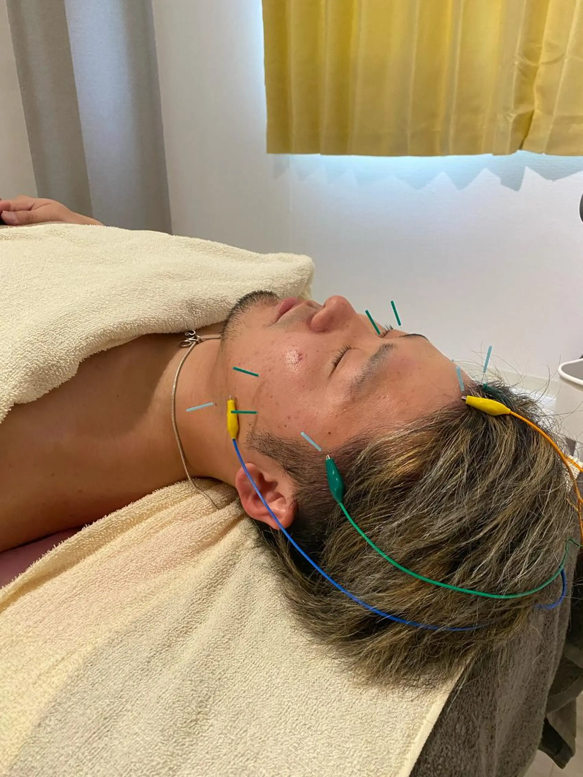 美容鍼サロン ハピネス所属・土手 真矢のその他イメージ