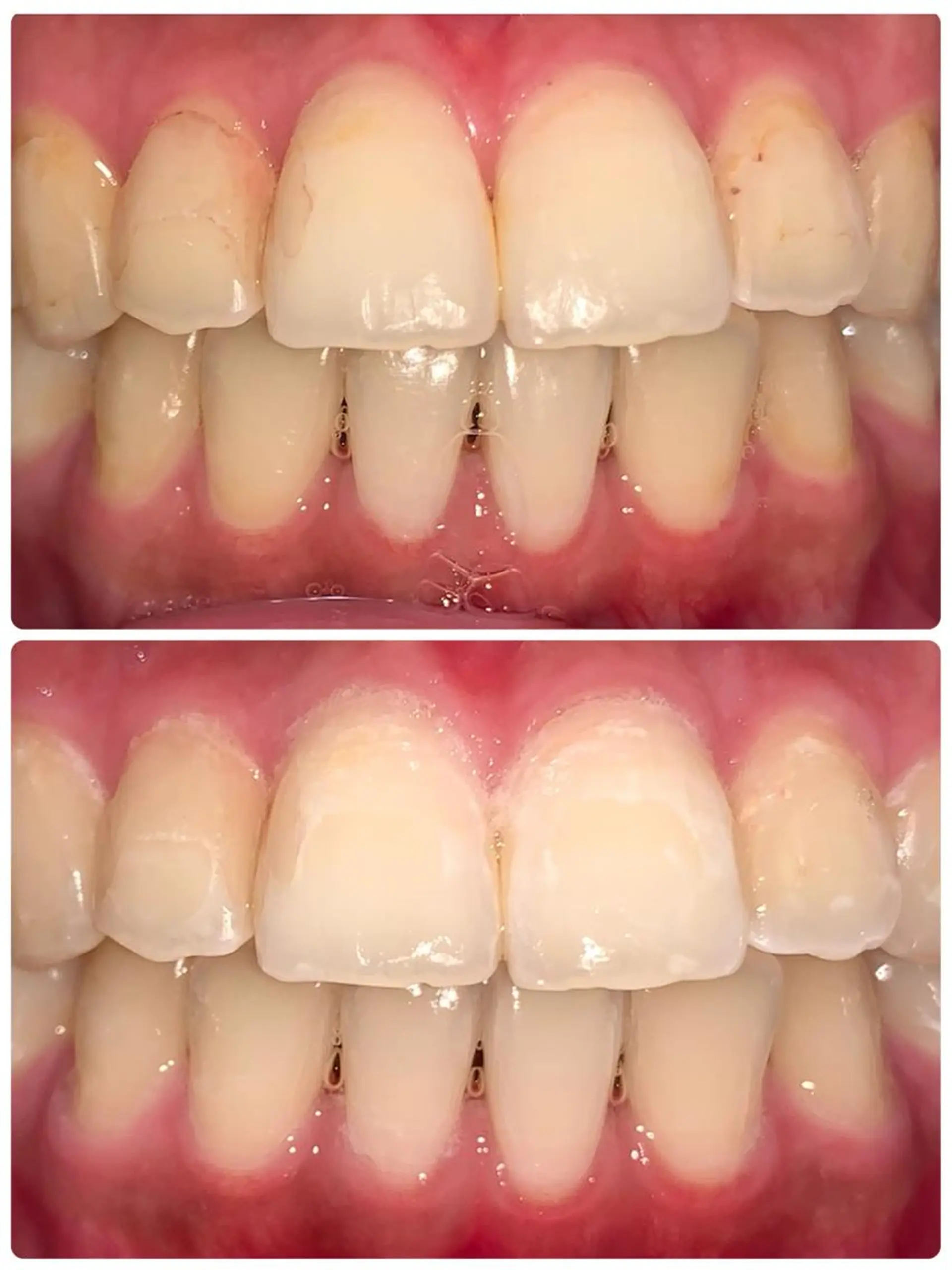 LOVE ホワイトニング渋谷のその他イメージ