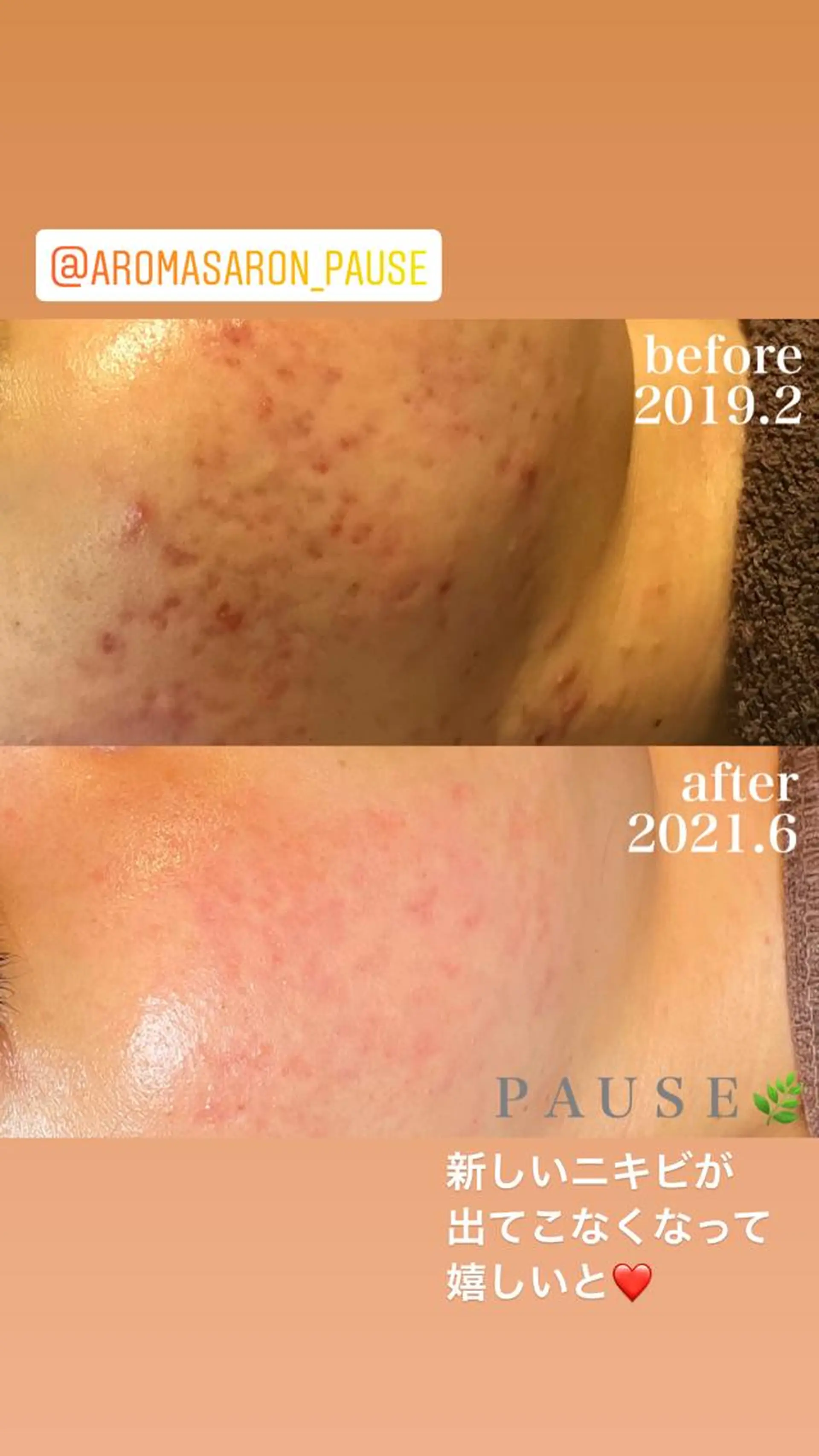 エステ リラク 浜野 恵美のエステ・リラクイメージ