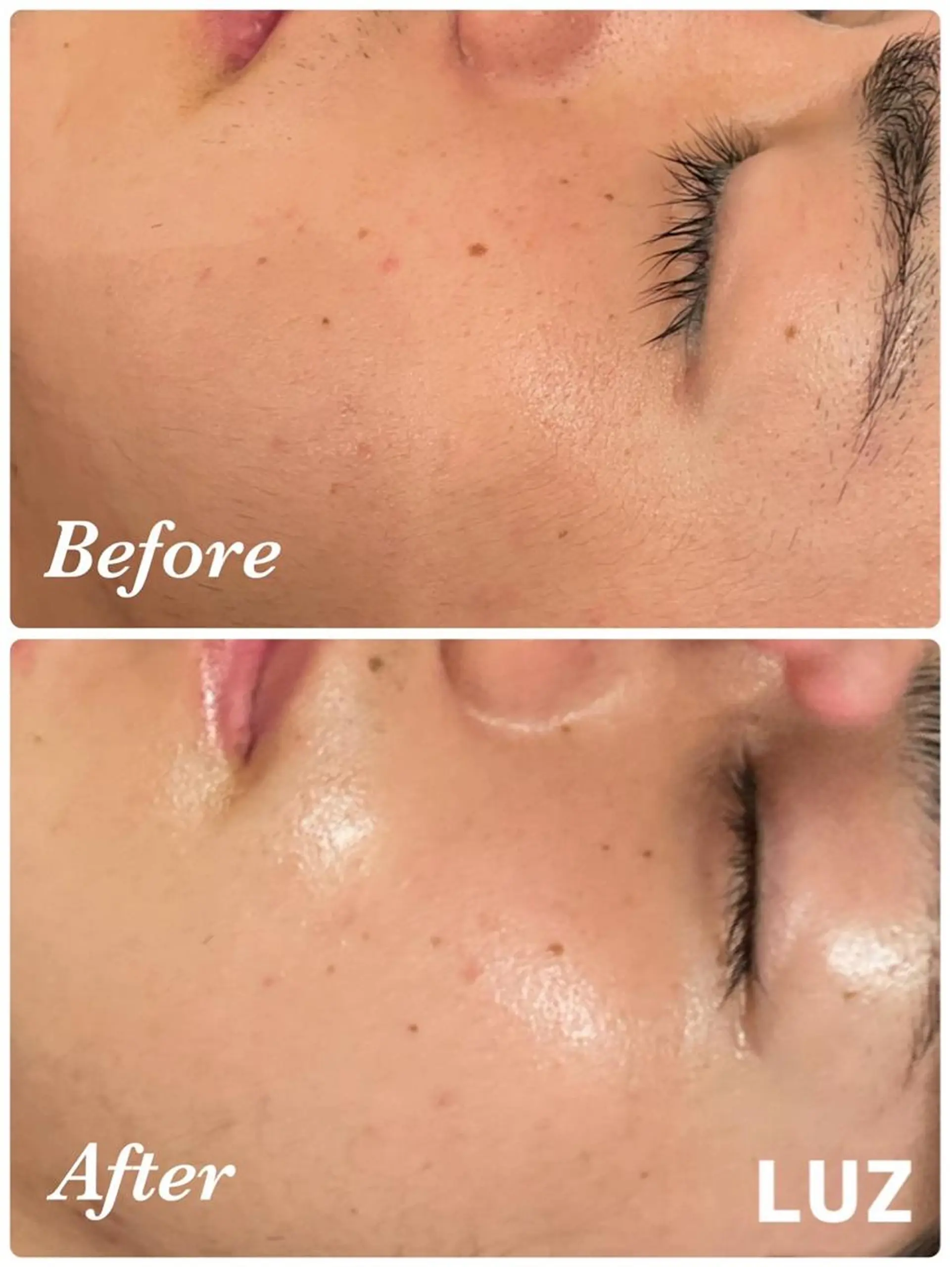 メンズ メンズフェイシャル アイブロウ・ルースのエステ・リラクイメージ