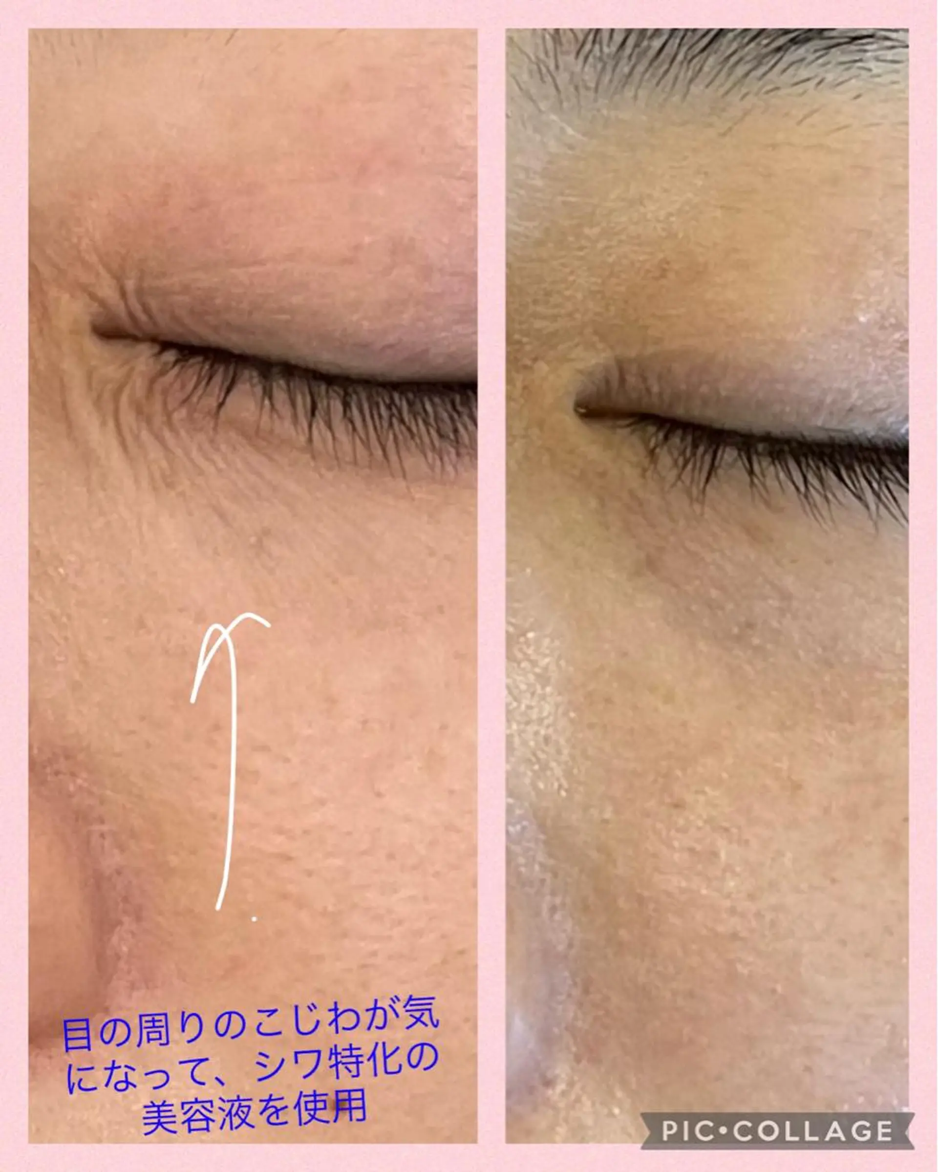 🅖🅤🅩🅔🅛 salonのエステ・リラクイメージ