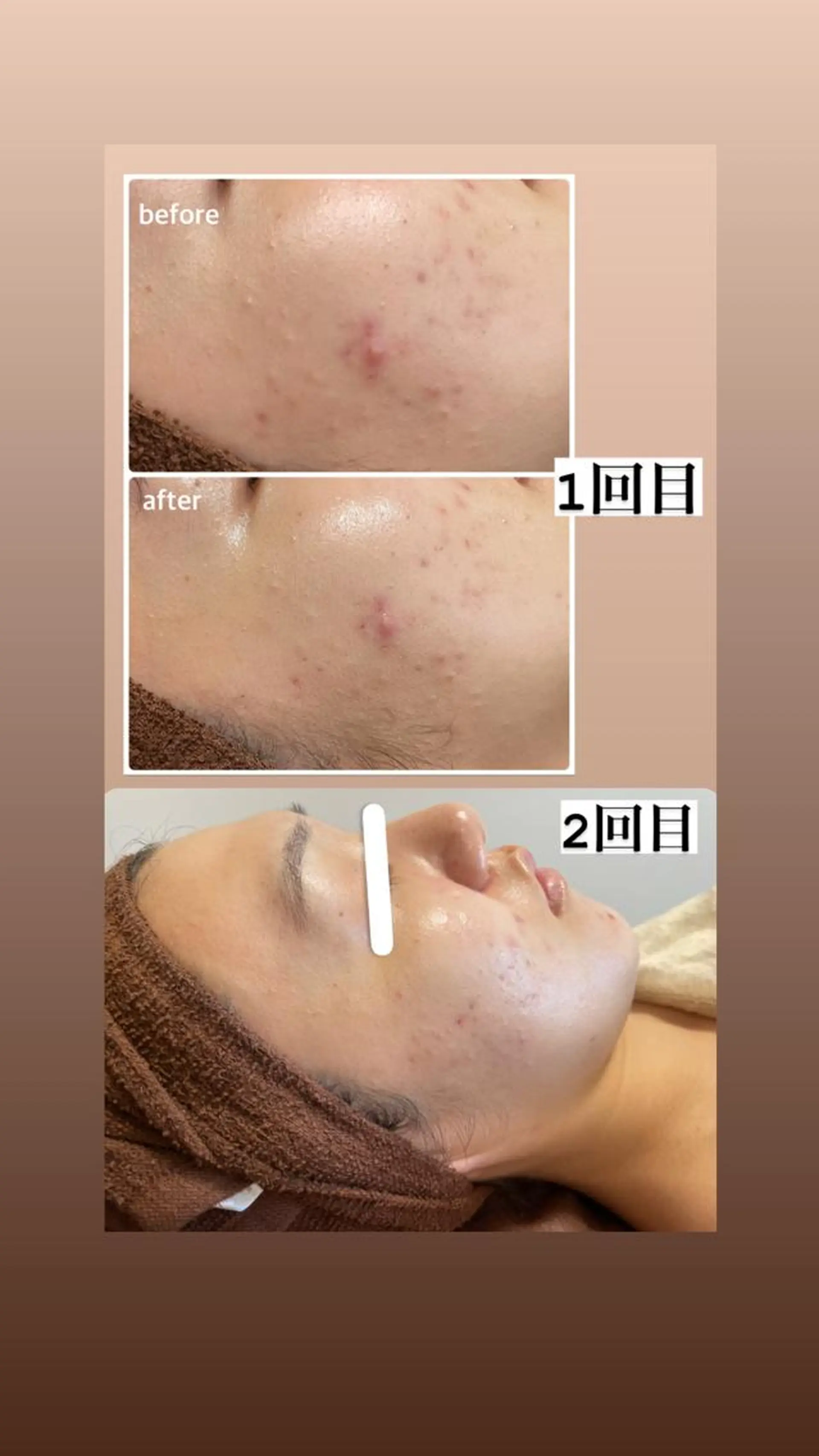 エステ リラク ビューティーサロン Claireのエステ・リラクイメージ