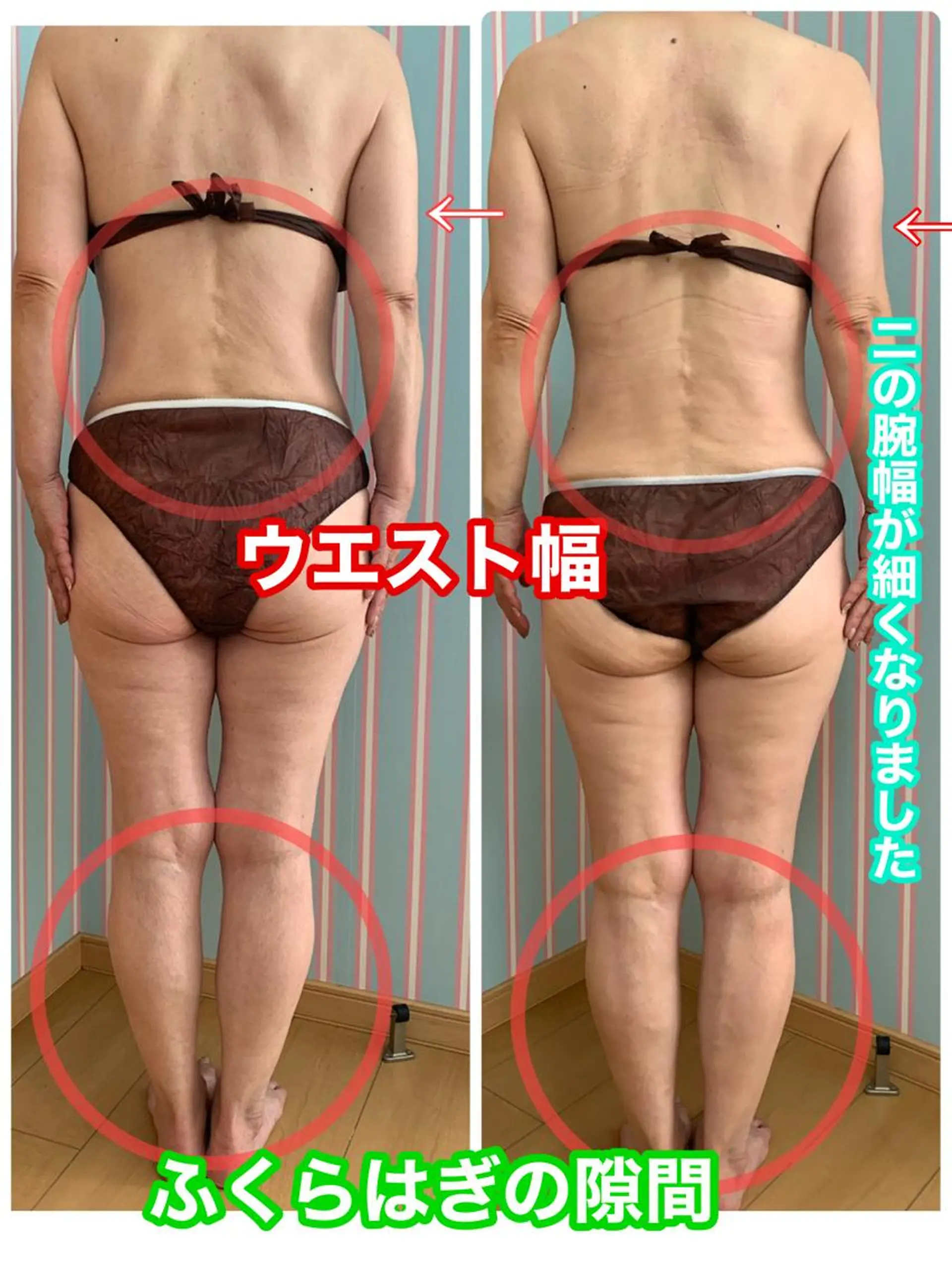 エステ リラク 痩身/脱毛/ネイル HARUKAのエステ・リラクイメージ