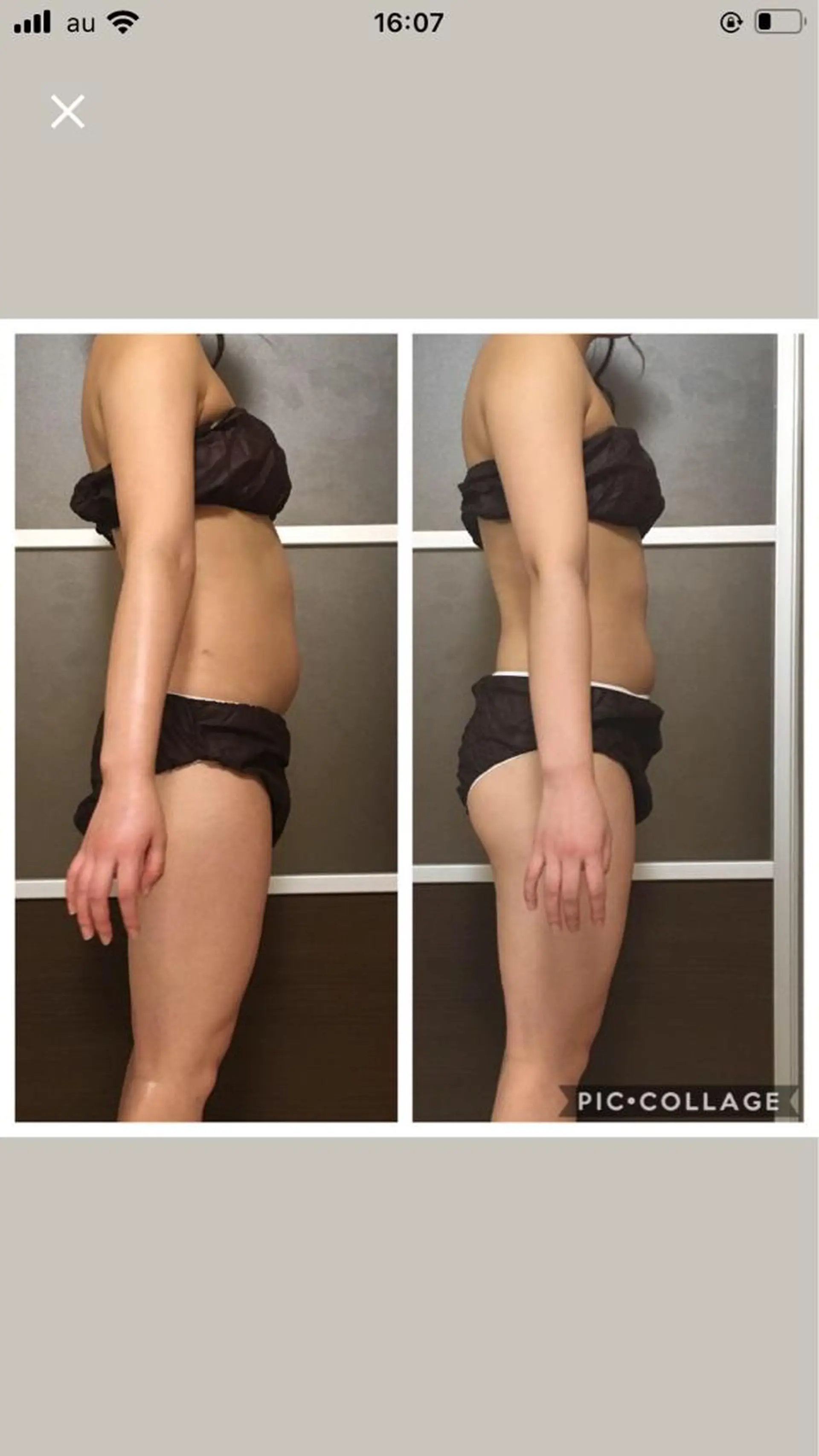 ミディアム カラー パーマ ヘアアレンジ メンズ キッズ ネイル マツエク・マツパ アニメ,Vオタク× 即効痩せエステサロンのエステ・リラクイメージ