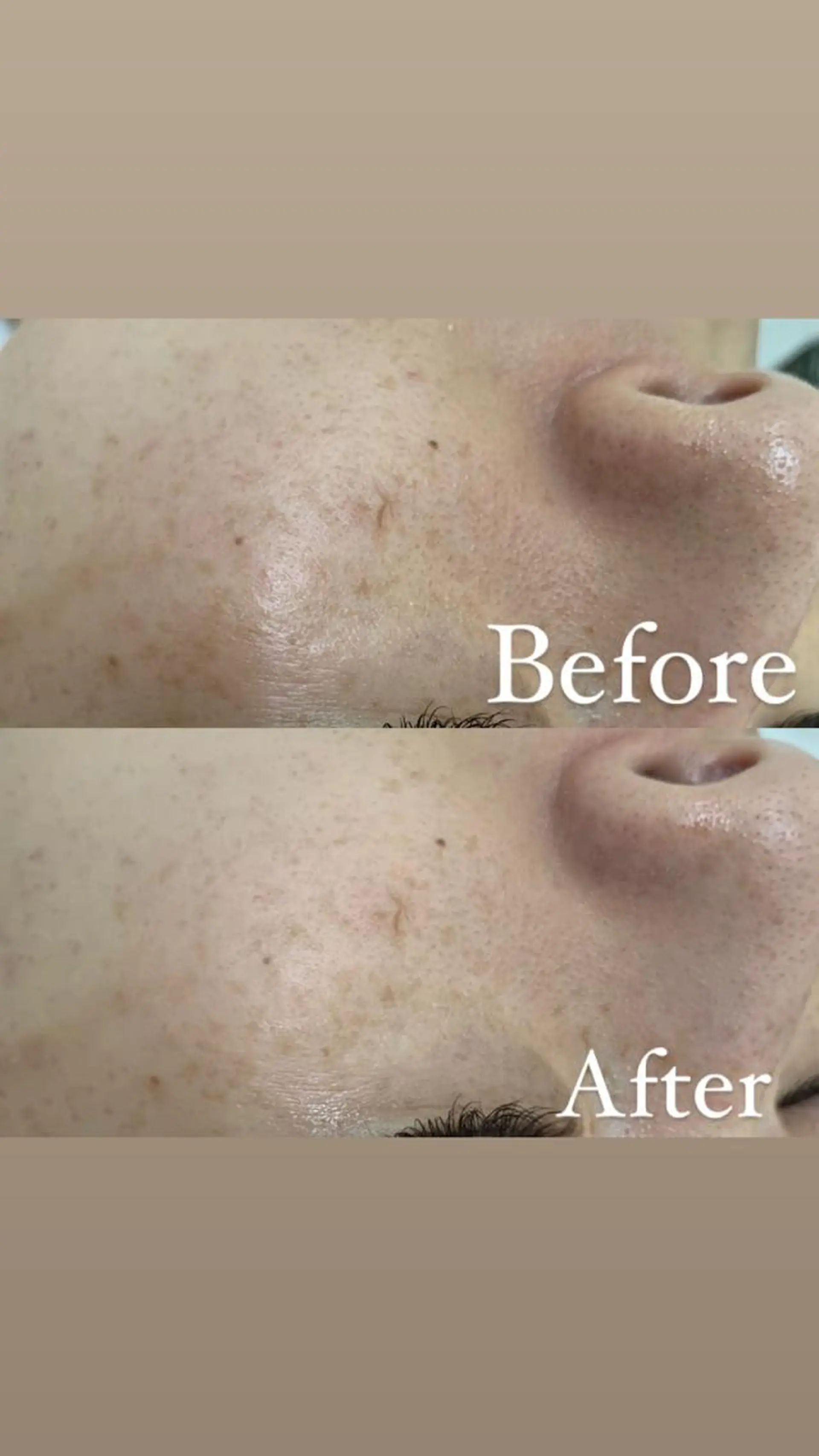 デ・アイム新潟　　北所属・山口 萌のエステ・リラクイメージ