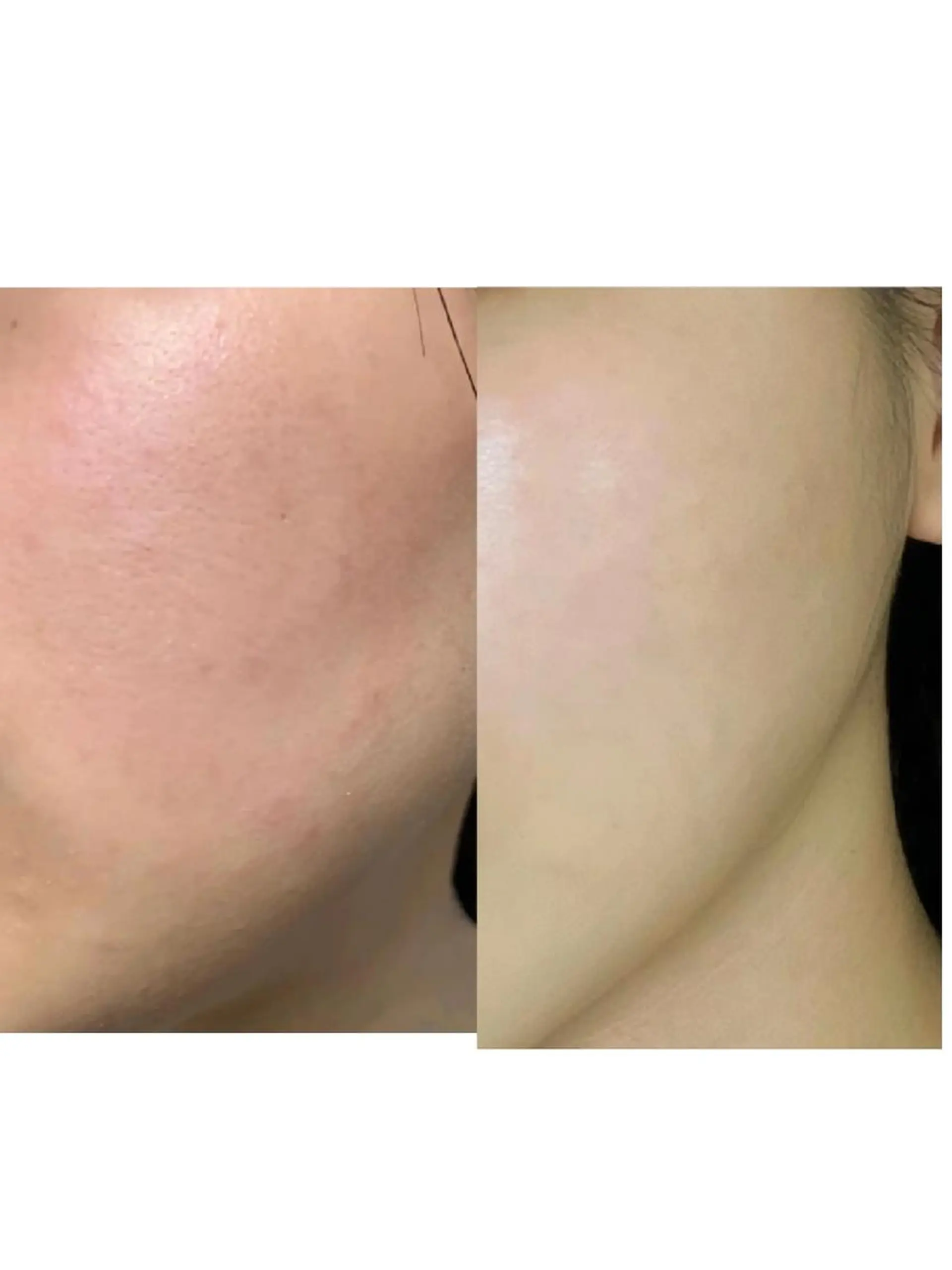 エステ aliaハイフ&水光ジェットサロン所属・aliaハーブ水光店 エステティシャン募集のエステ・リラクイメージ