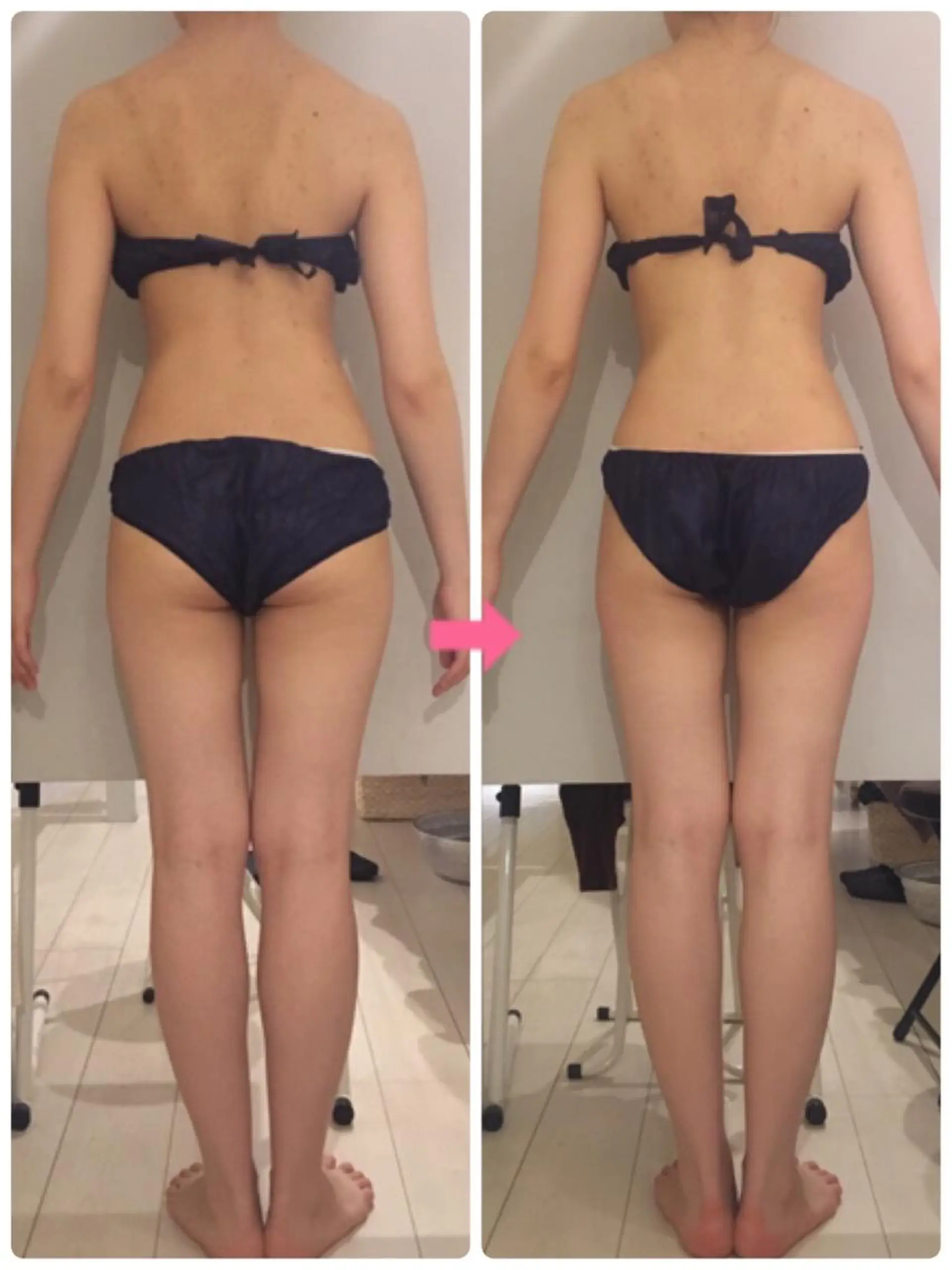 ショート カラー パーマ ヘアアレンジ メンズ キッズ ネイル マツエク・マツパ ‍痩身＆ボディ 結果出し🌟丹野のエステ・リラクイメージ