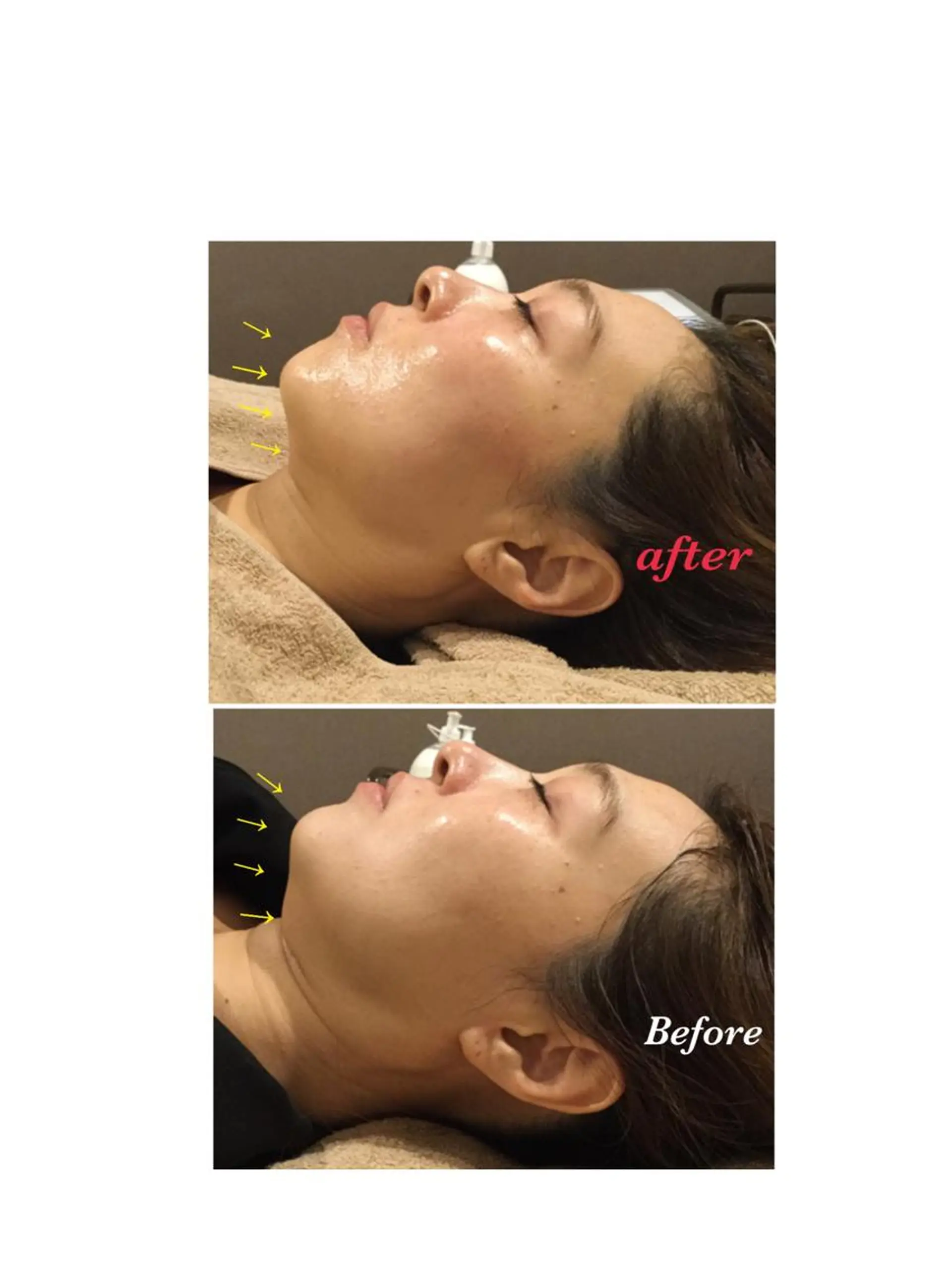 【リベルハーブピーリング認定店】敏感肌・美白脱毛専門店Dione立川店所属・Dione 立川店のエステ・リラクイメージ