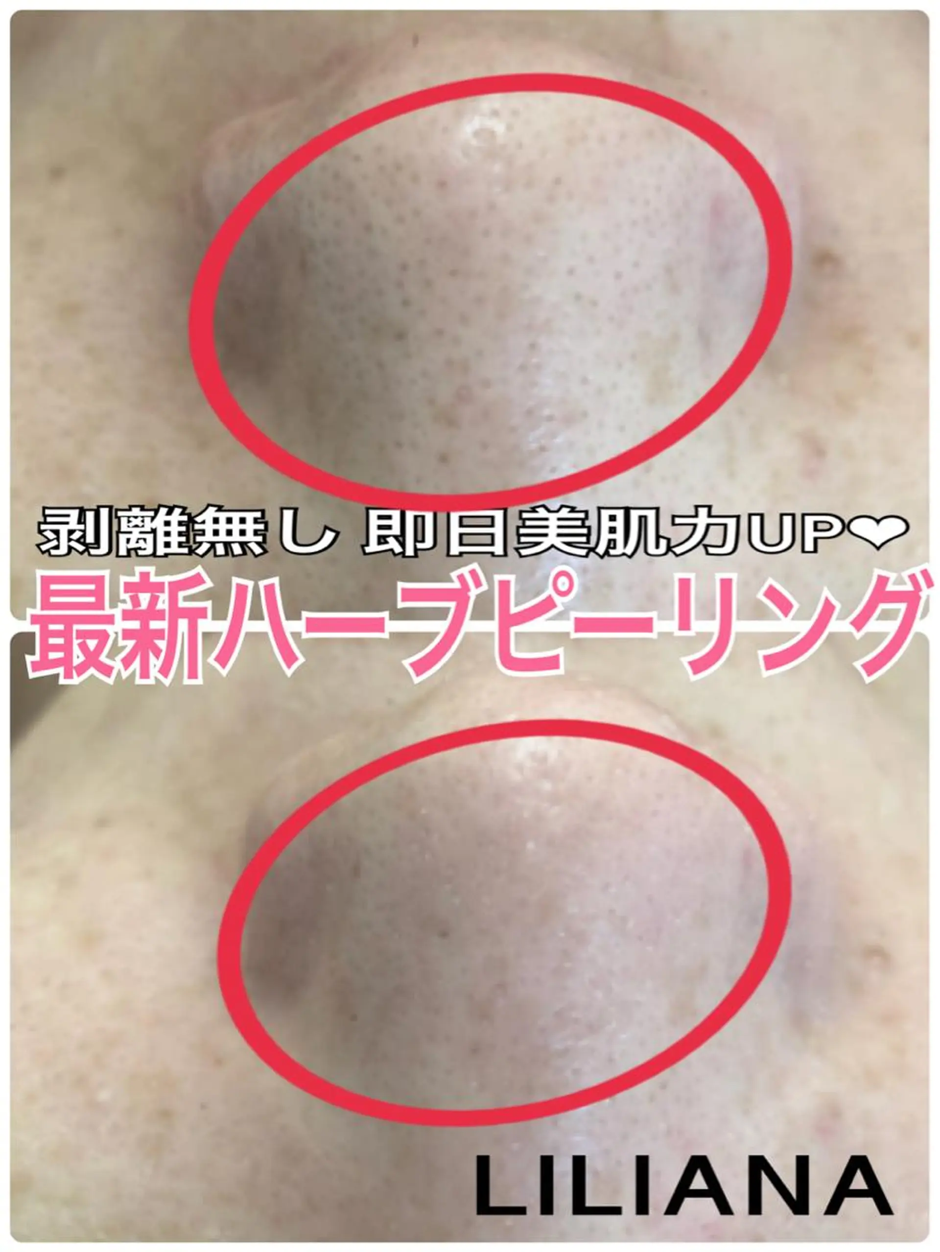 エステ リラク LILIANA所属・LILIANA ☆YURIのエステ・リラクイメージ