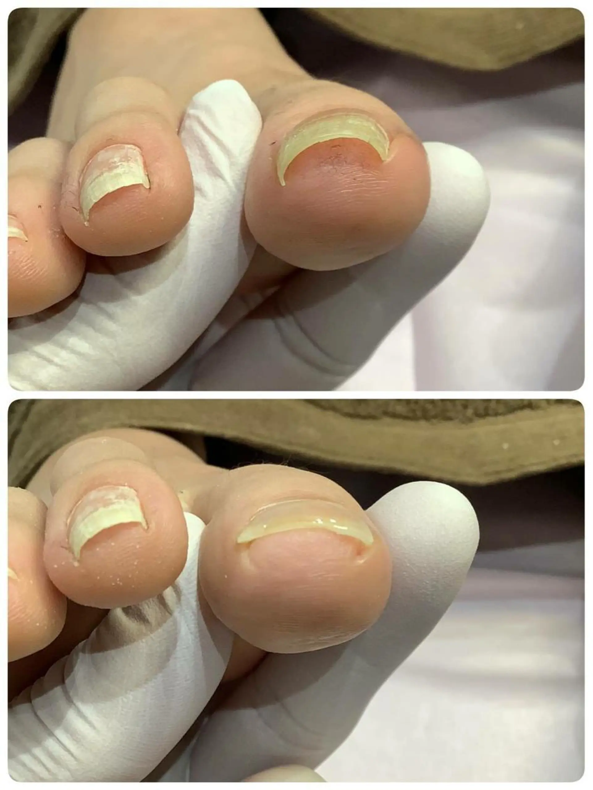 東京巻き爪アカデミー所属・東京巻き爪 アカデミーのエステ・リラクイメージ