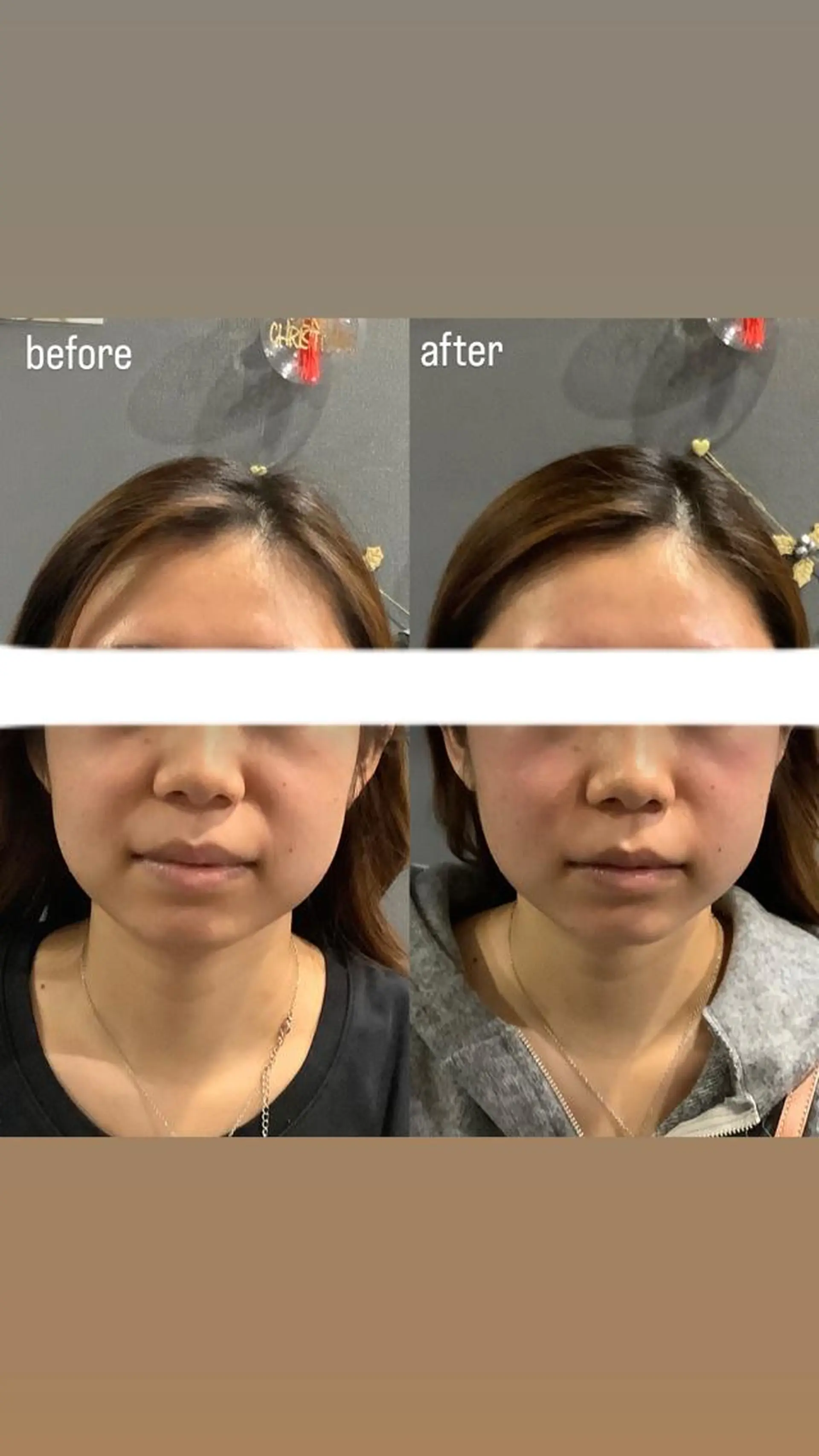 エステ リラク エステサロンino.colore'所属・小顔サロン ino.coloreのエステ・リラクイメージ