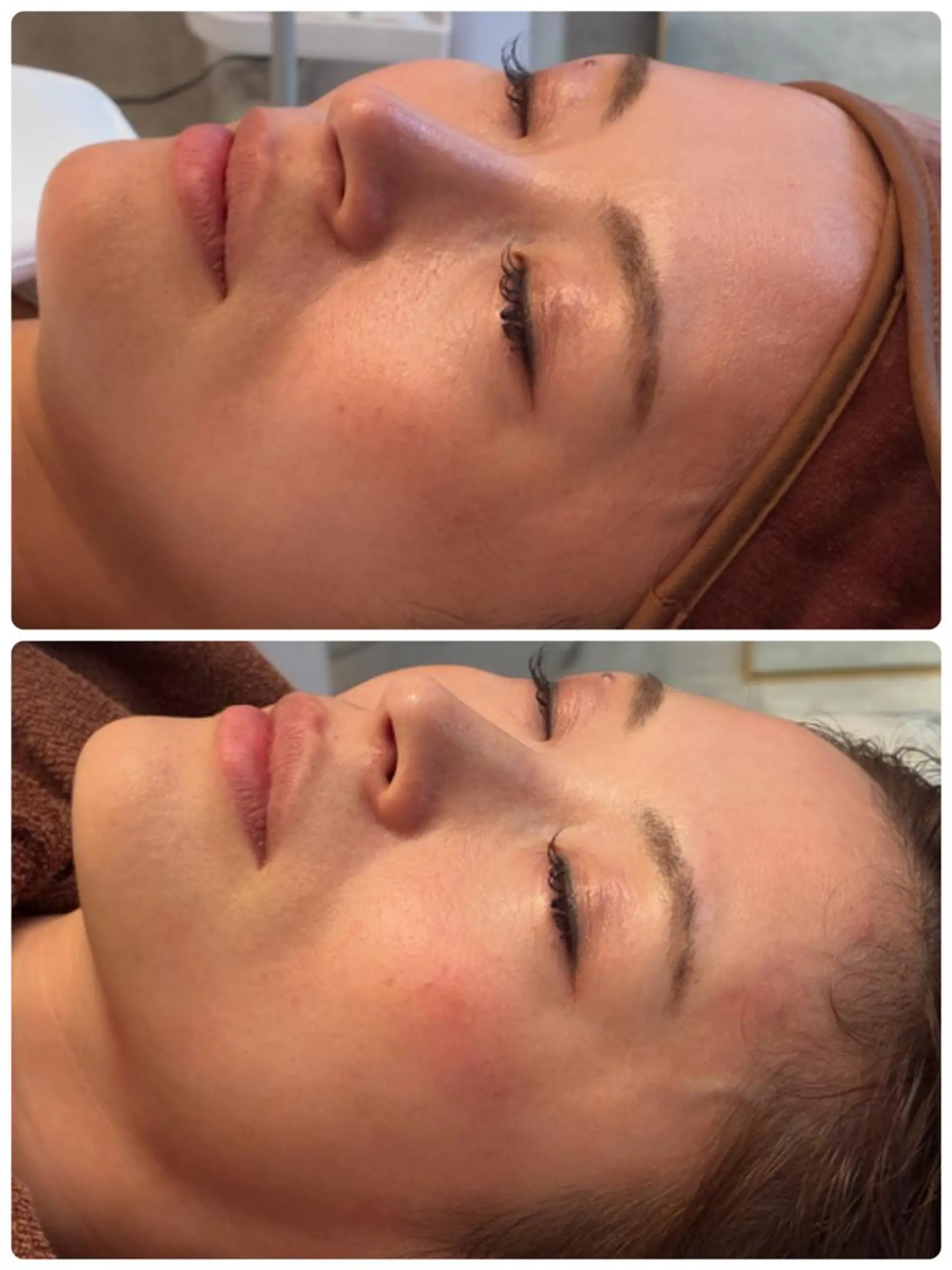 FLEURフェイシャ ル🫧ハーブ🌿小顔のエステ・リラクイメージ