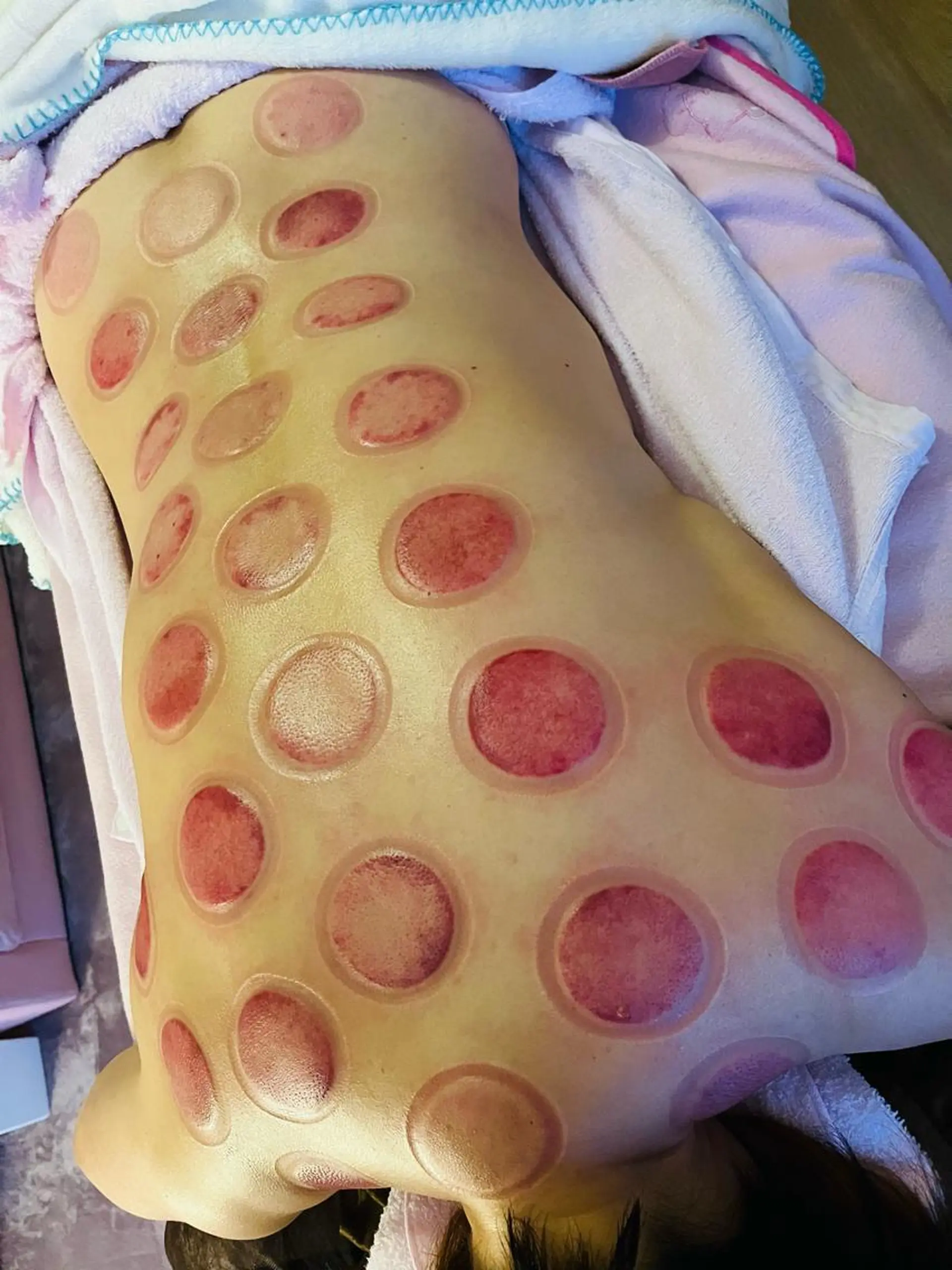 アロマ･美容鍼･カッ ピング「麗」鍼灸院のエステ・リラクイメージ