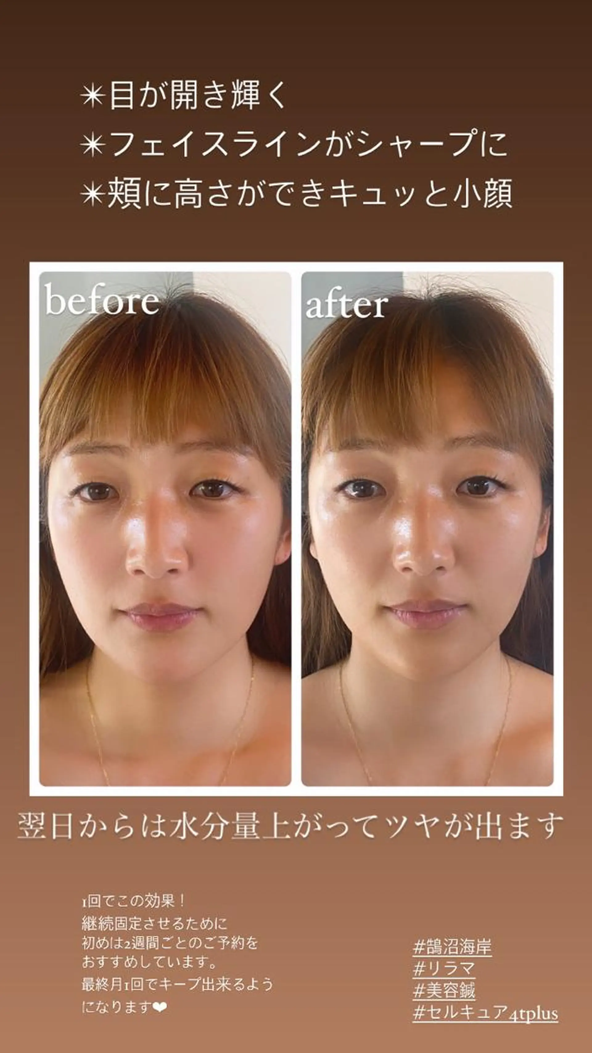 Relama　美容鍼×マッサージ所属・Relama/リラマ 美容鍼×マッサージのエステ・リラクイメージ