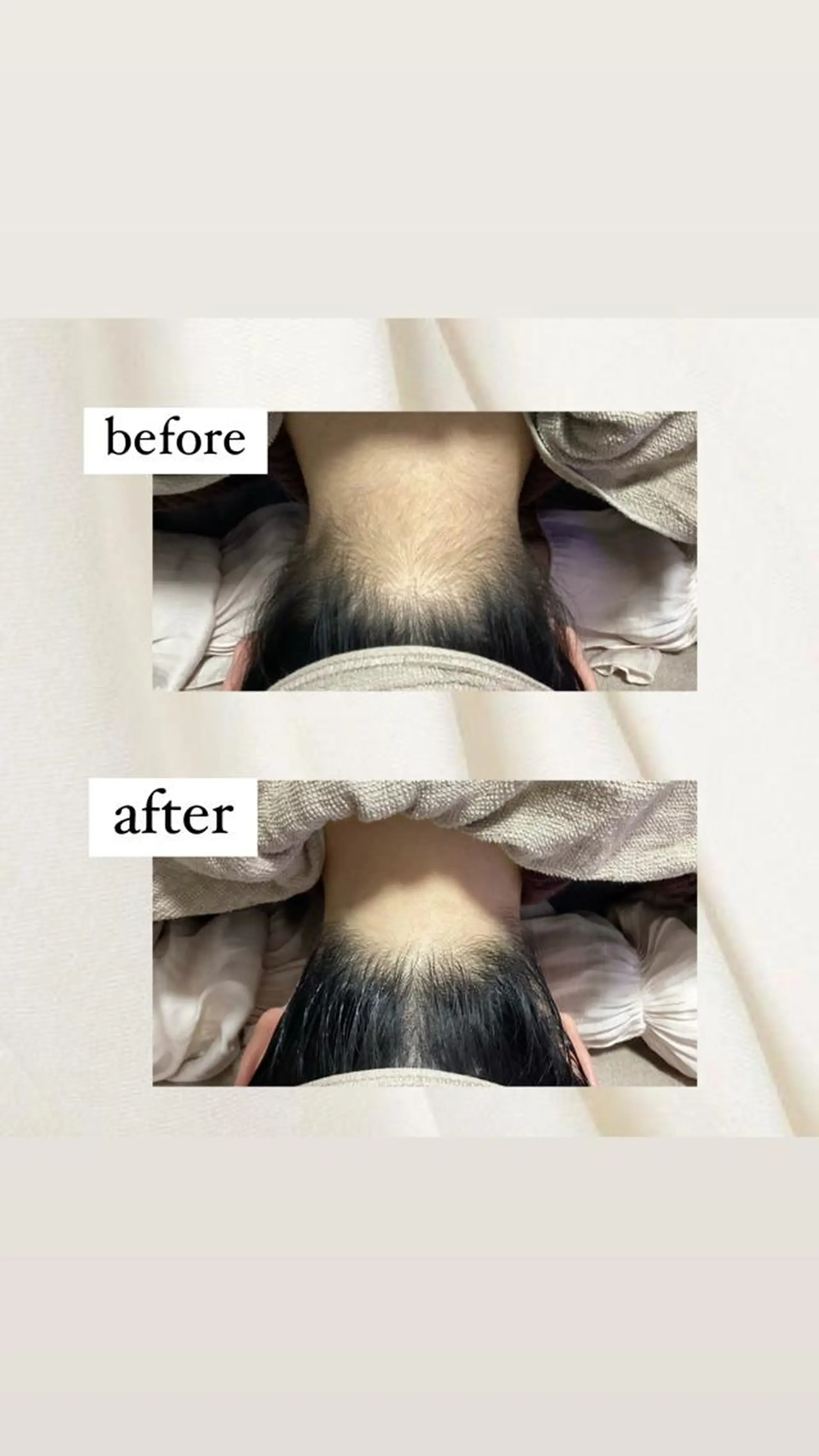 脱毛 crescent所属・【韓国肌管理・脱毛】 クレセントのその他イメージ