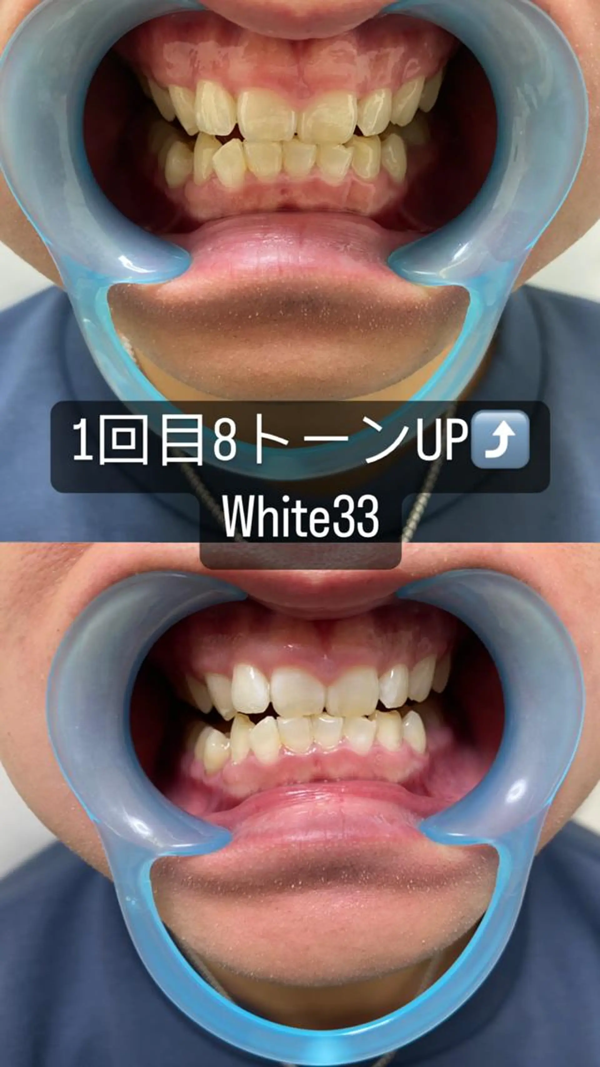 メンズ メンズパーマ セルフホワイトニング White33大名のその他イメージ