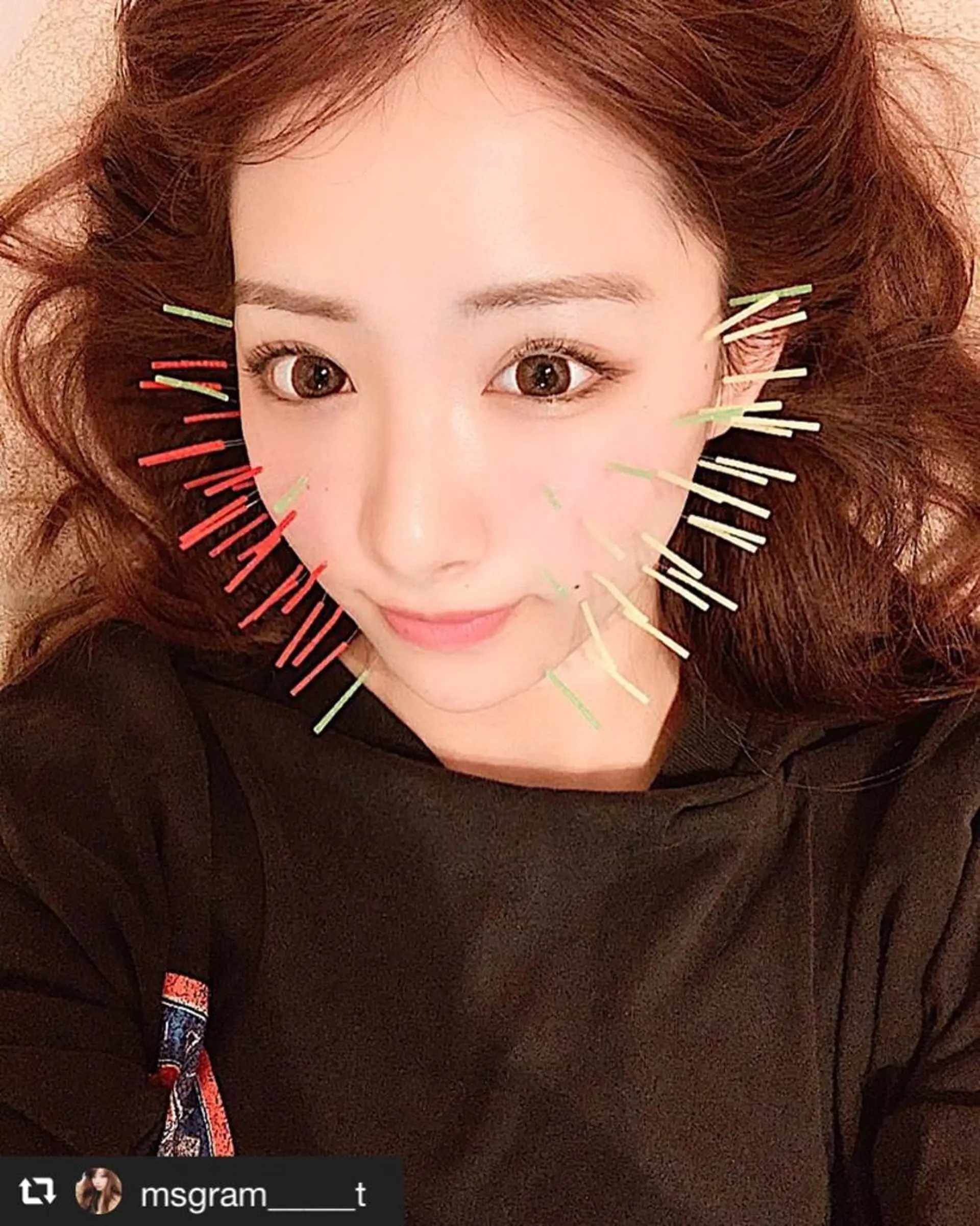 鍼灸整骨院Refine所属・鍼灸 Refineのその他イメージ