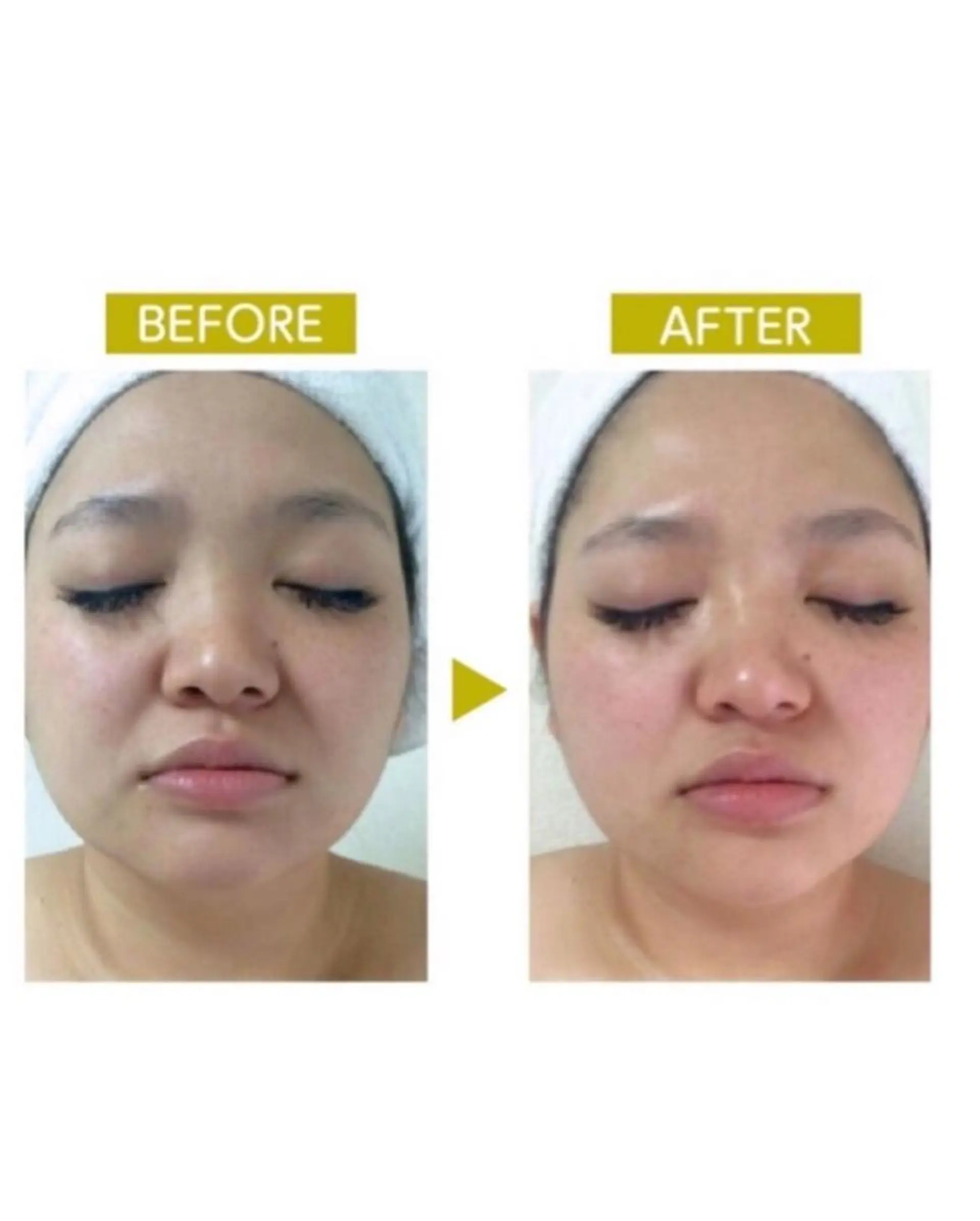 脱毛・エステサロン LuLuNのエステ・リラクイメージ