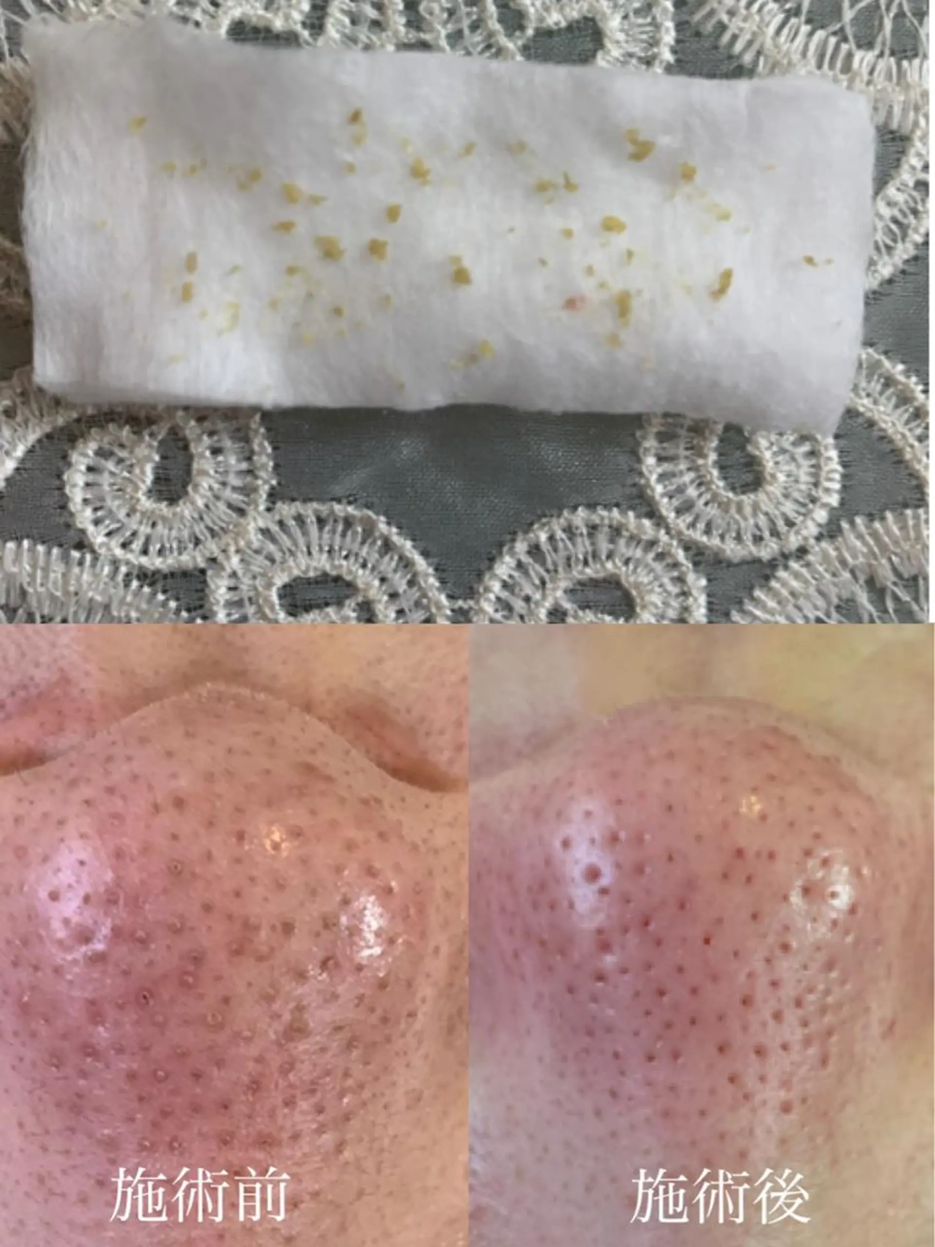 後藤 あきこのマツエク・マツパデザイン