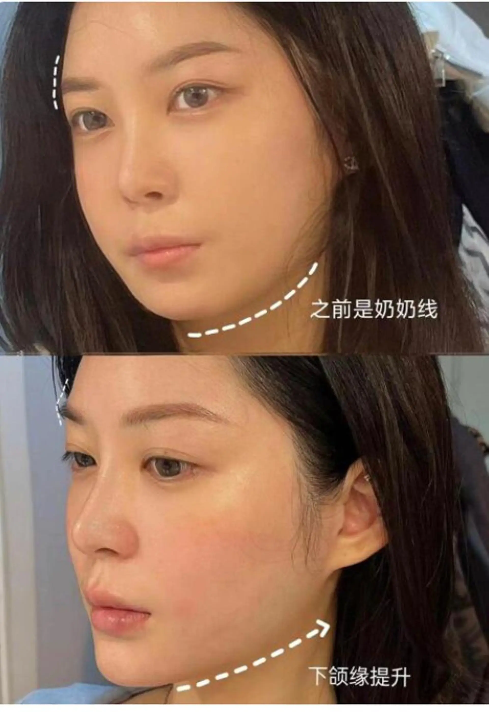 ショート カラー パーマ ネイル マツエク・マツパ 透明感カラー エステ aliaハイフ&水光ジェットサロン所属・aliaハーブ水光店 エステティシャン募集のエステ・リラクイメージ