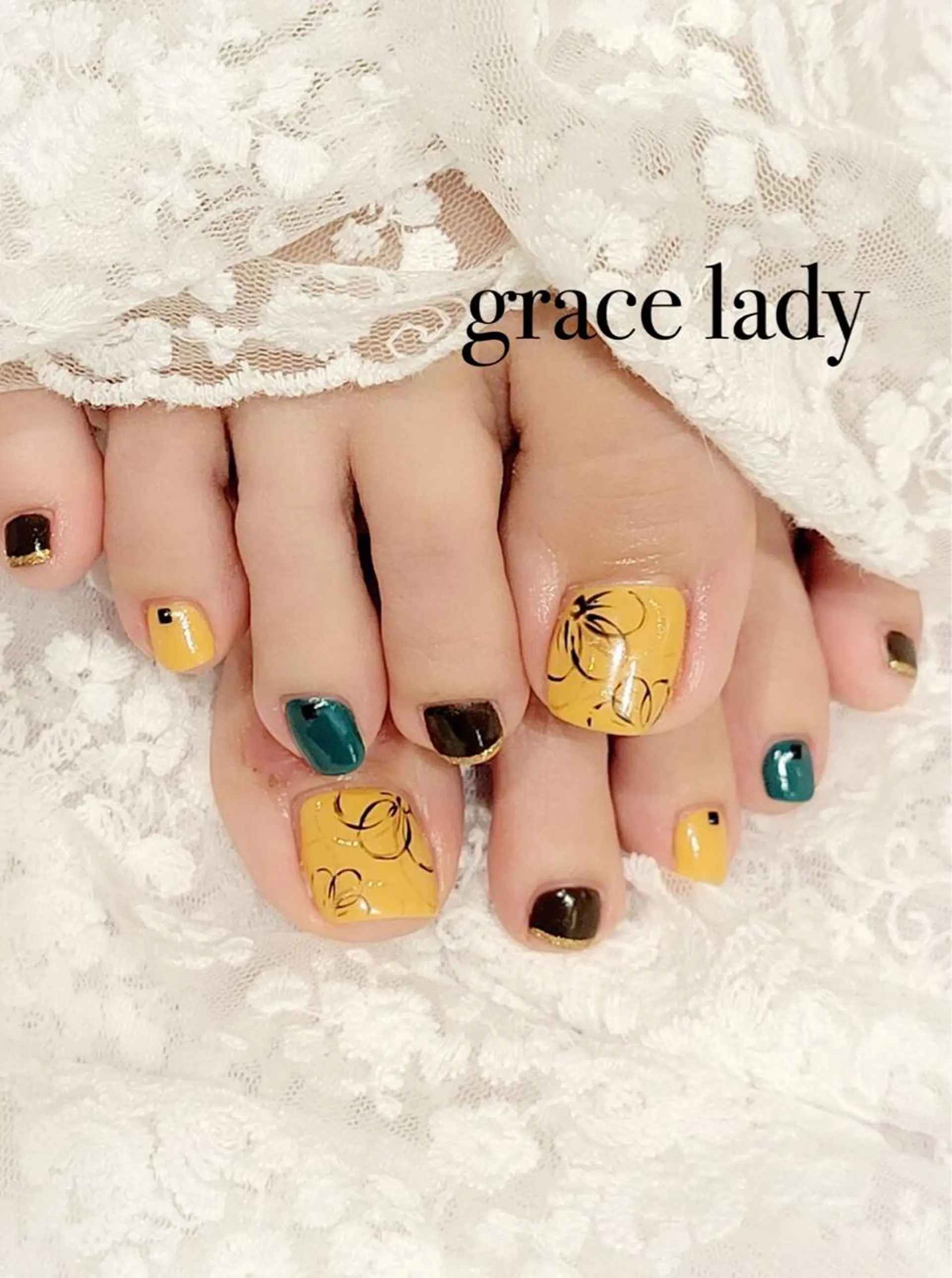 ネイル グレースレディ所属・深爪矯正長さ出し専門 グレースレディのネイルデザイン