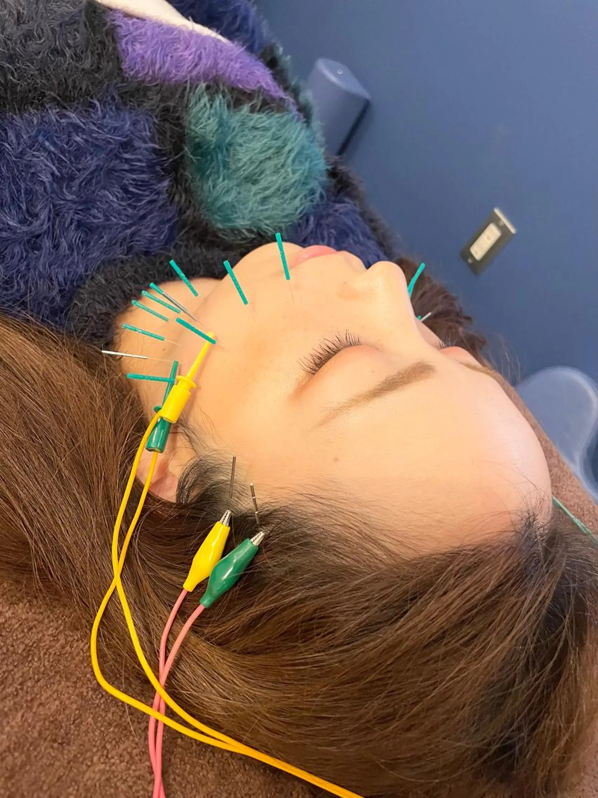 美容鍼　蒼月-aotsuki-所属・美容鍼「蒼月」 -アオツキ-のエステ・リラクイメージ