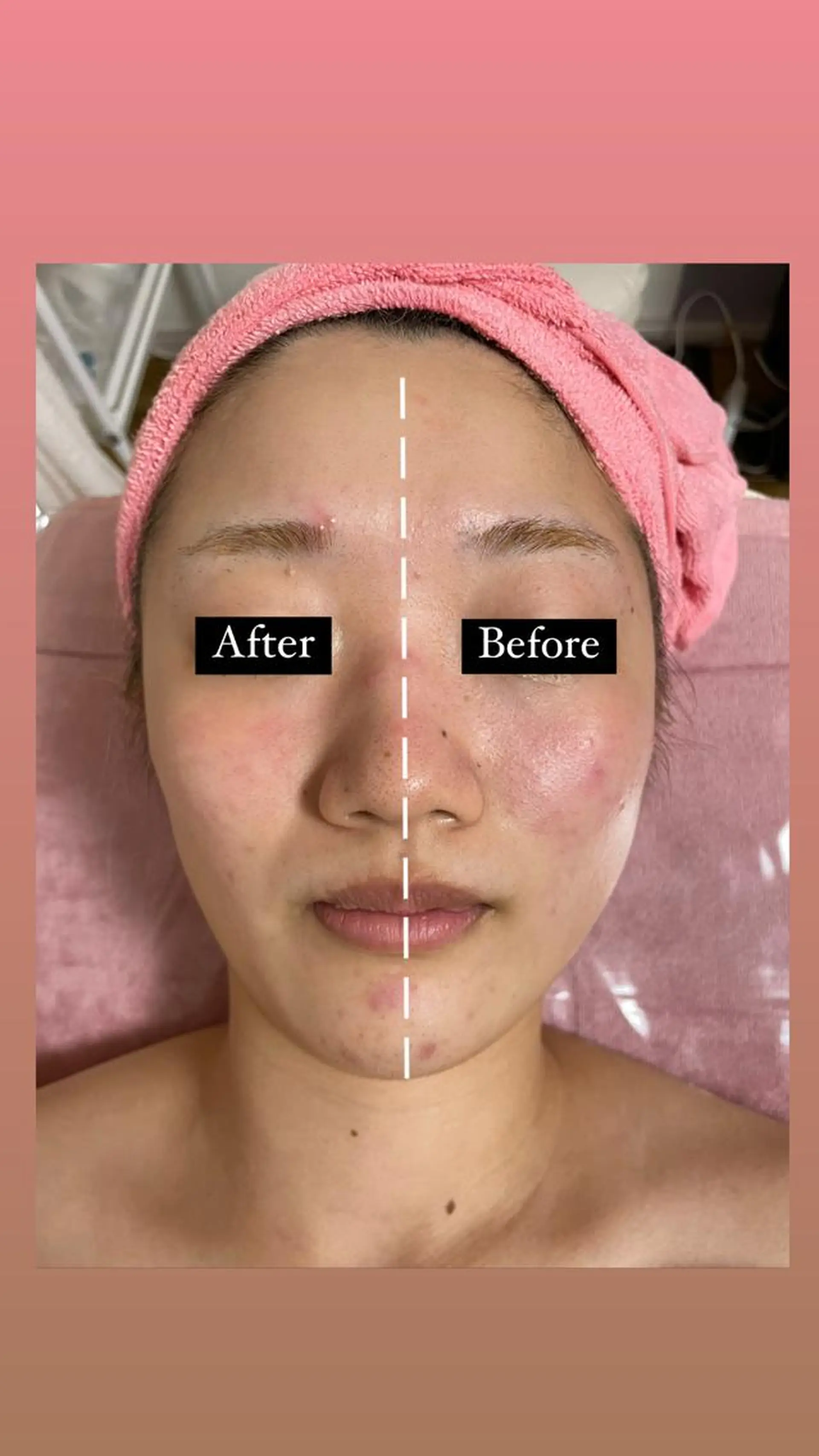 透明感の肌Lino malieのエステ・リラクイメージ