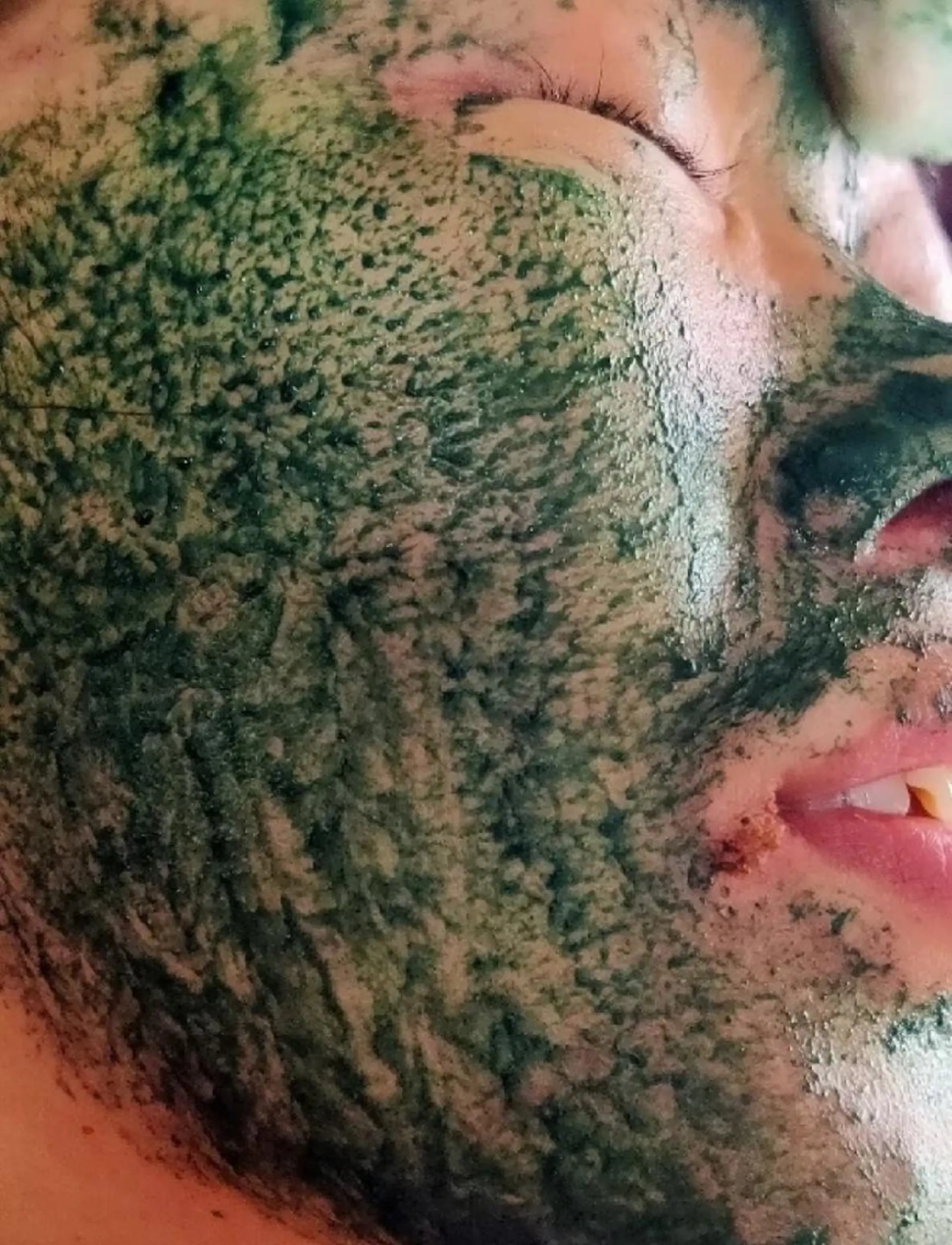 エステ aliaハイフ&水光ジェットサロン所属・aliaハーブ水光店 エステティシャン募集のエステ・リラクイメージ