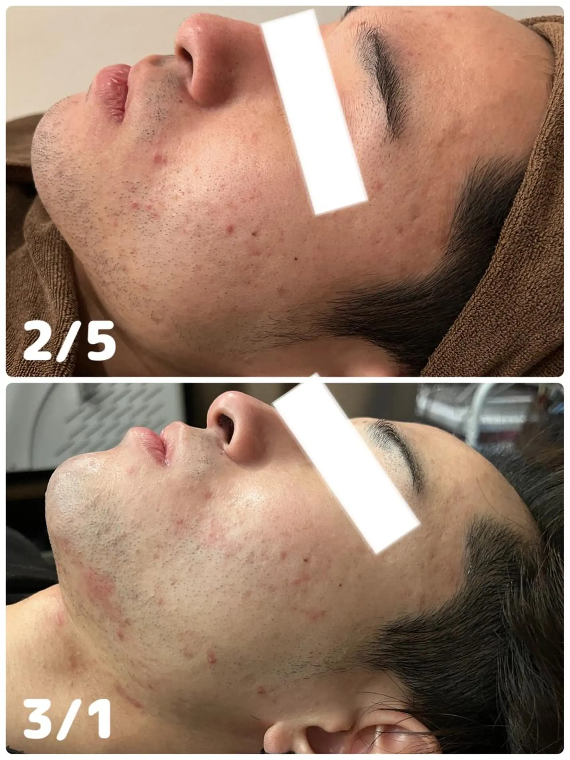 メンズ Folche博多 吉冨のエステ・リラクイメージ