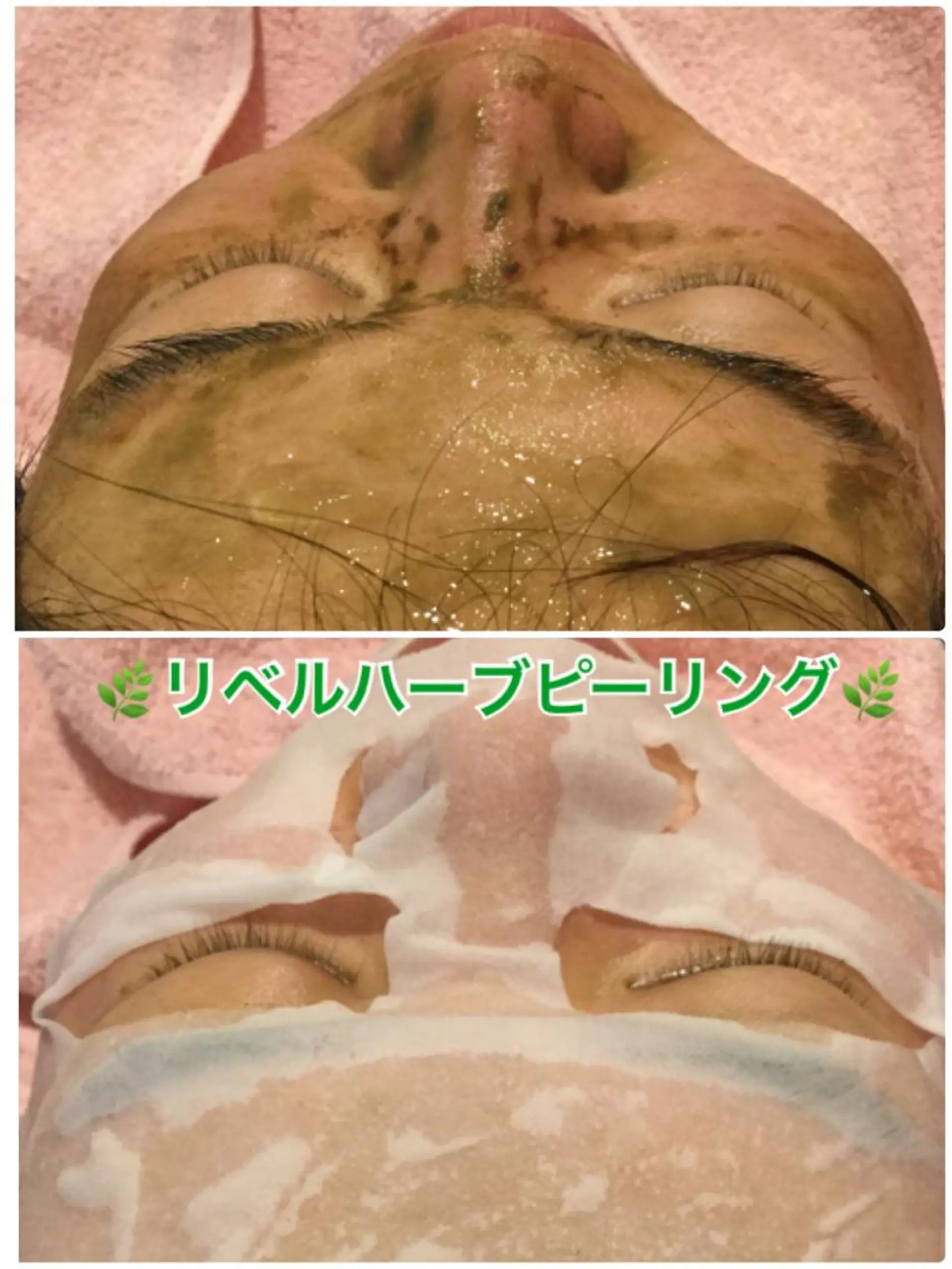 エステ 【リベルハーブピーリング認定店】敏感肌・美白脱毛専門店Dione立川店所属・Dione 立川店のエステ・リラクイメージ