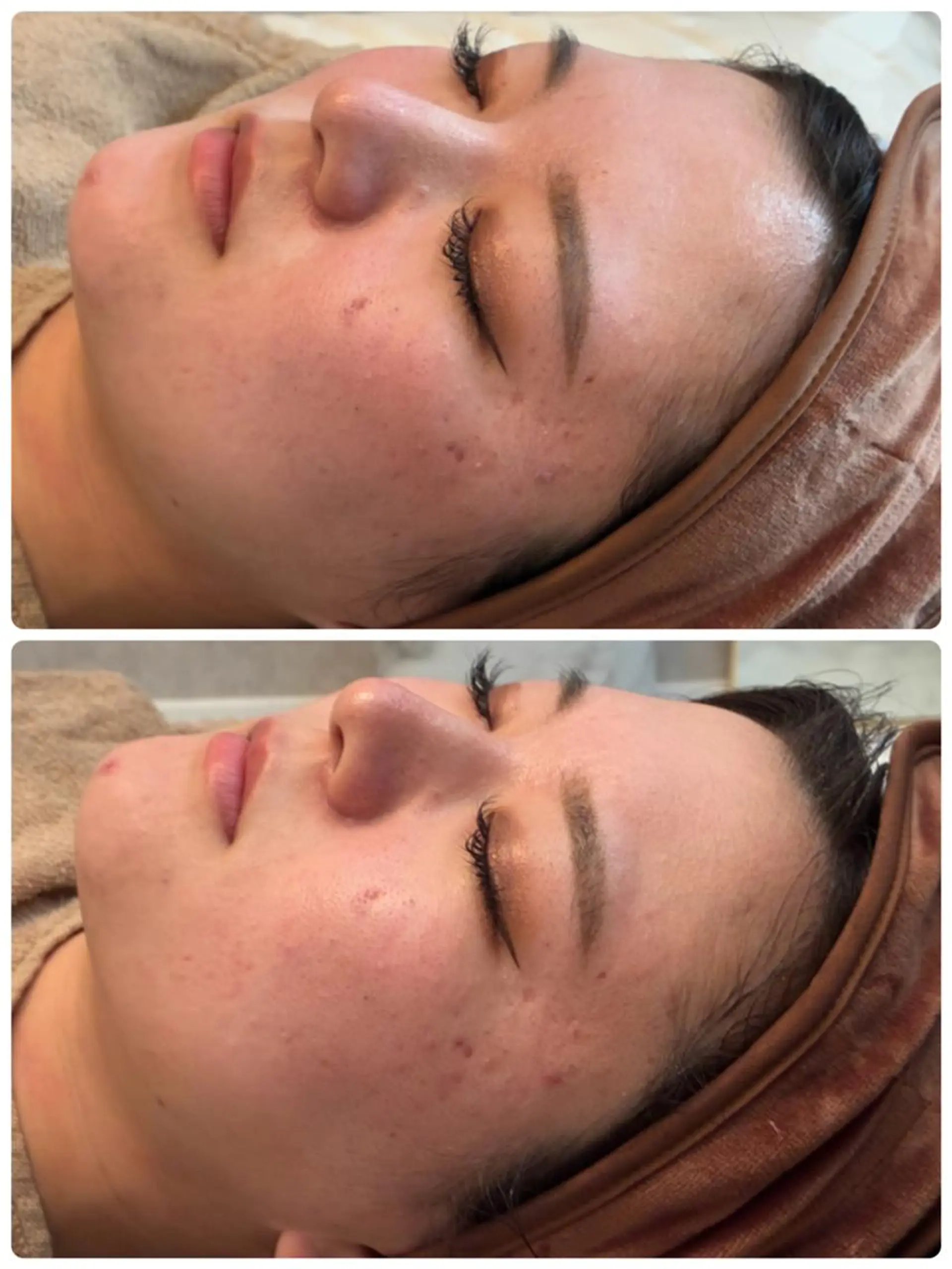 FLEURフェイシャ ル🫧ハーブ🌿小顔のエステ・リラクイメージ