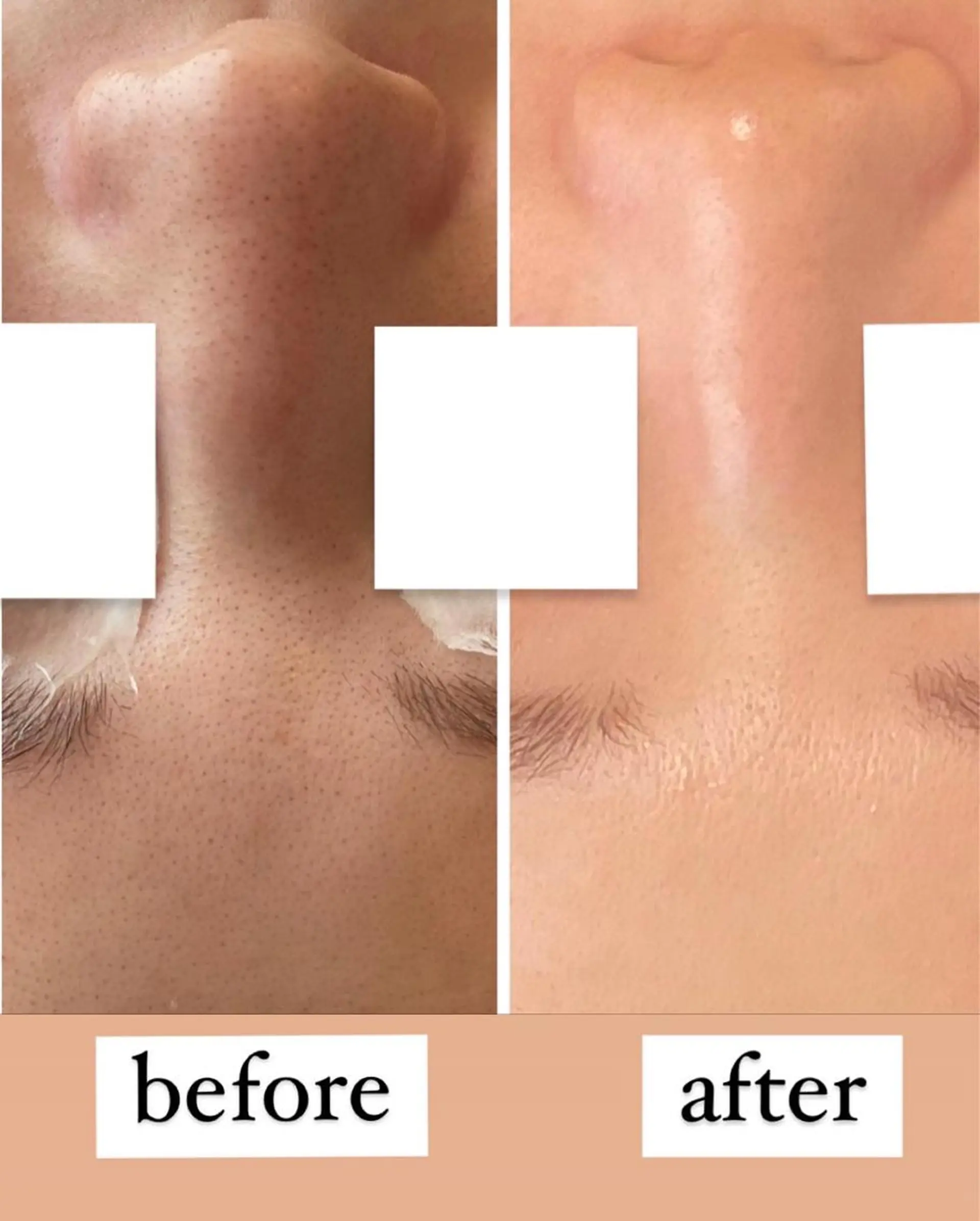 Lien~毛穴 専門サロンのその他イメージ